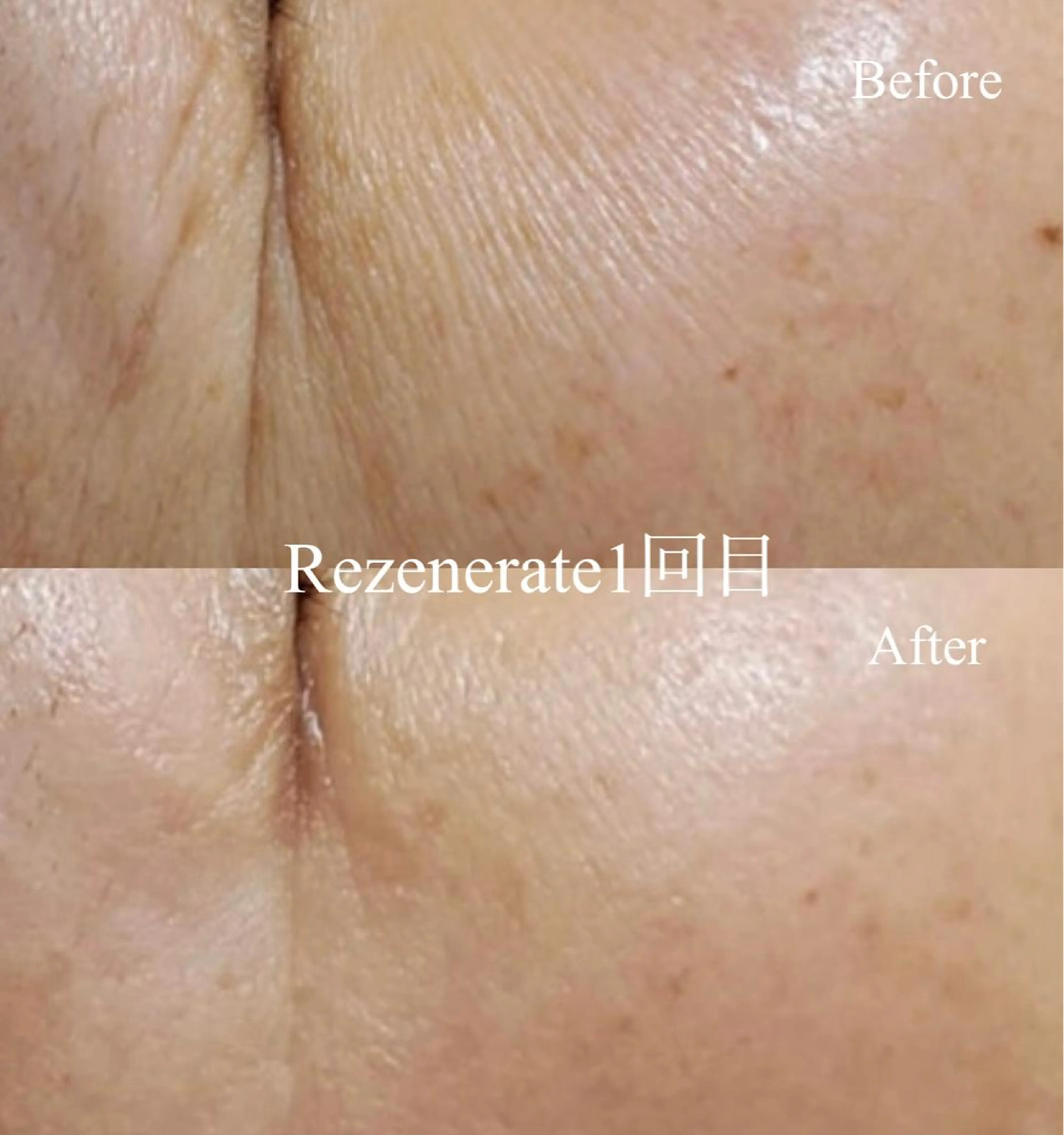 エステ Ailes de Ange　MARIのエステ・リラクイメージ