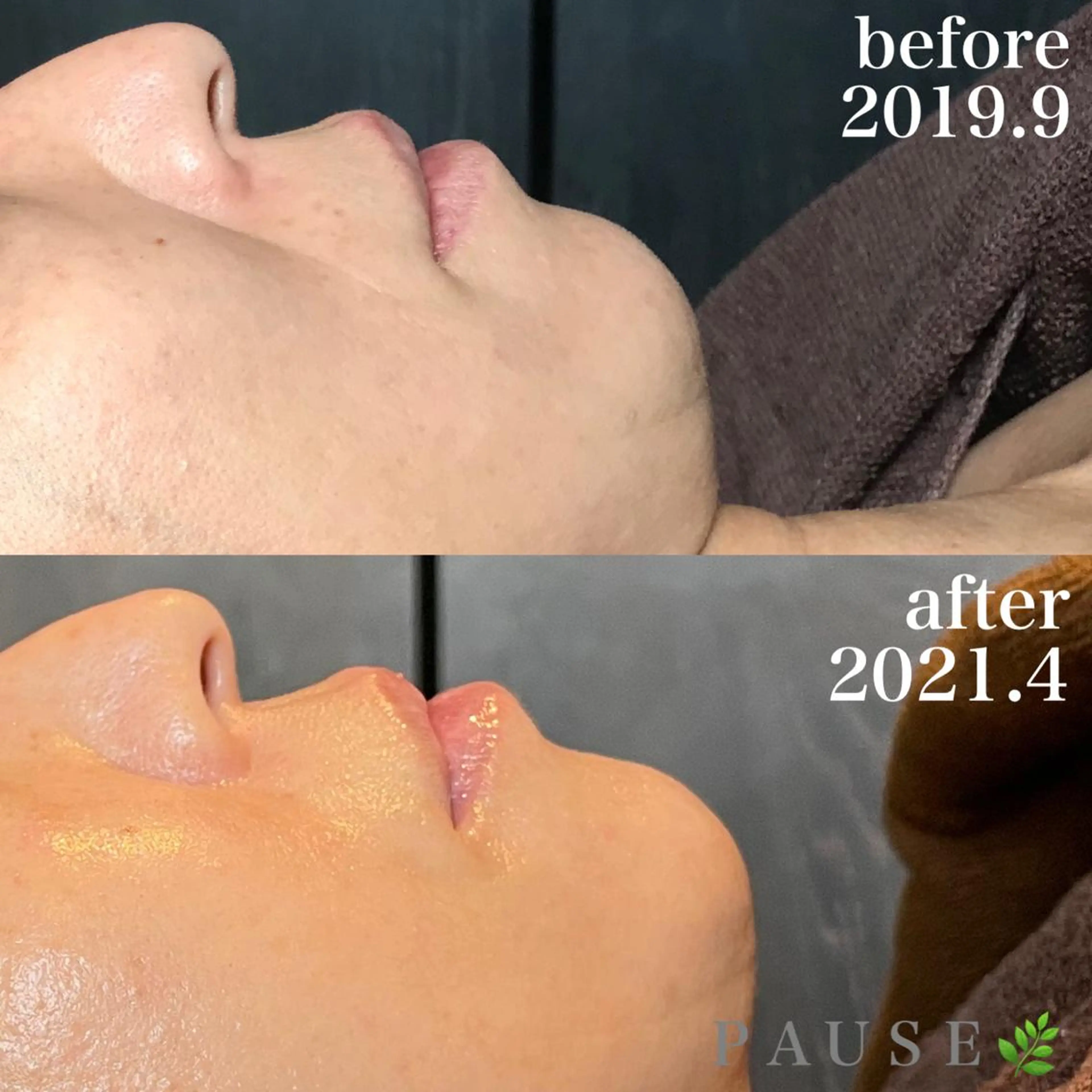 エステ 浜野 恵美のエステ・リラクイメージ