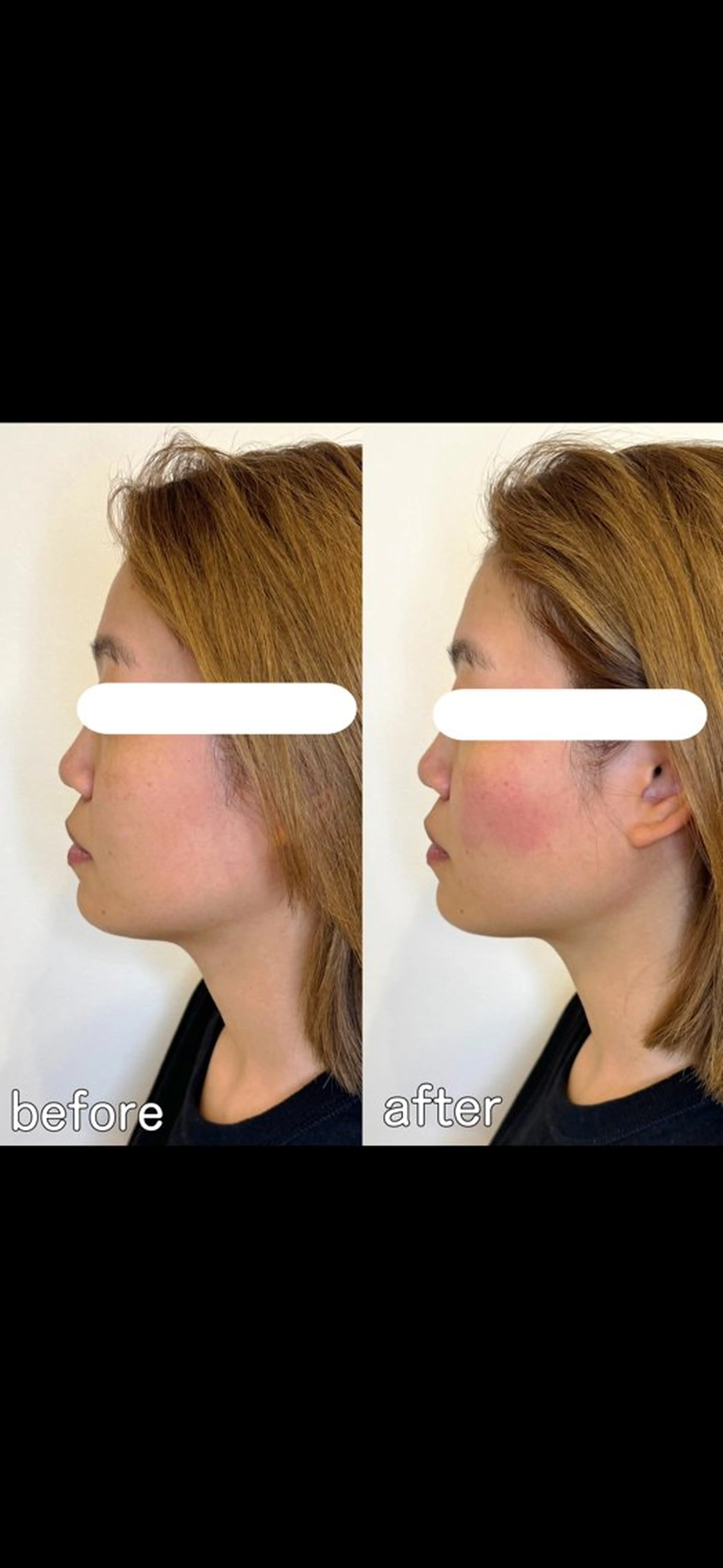 小顔矯正&美容整体 整え屋REDオーナーのエステ・リラクイメージ