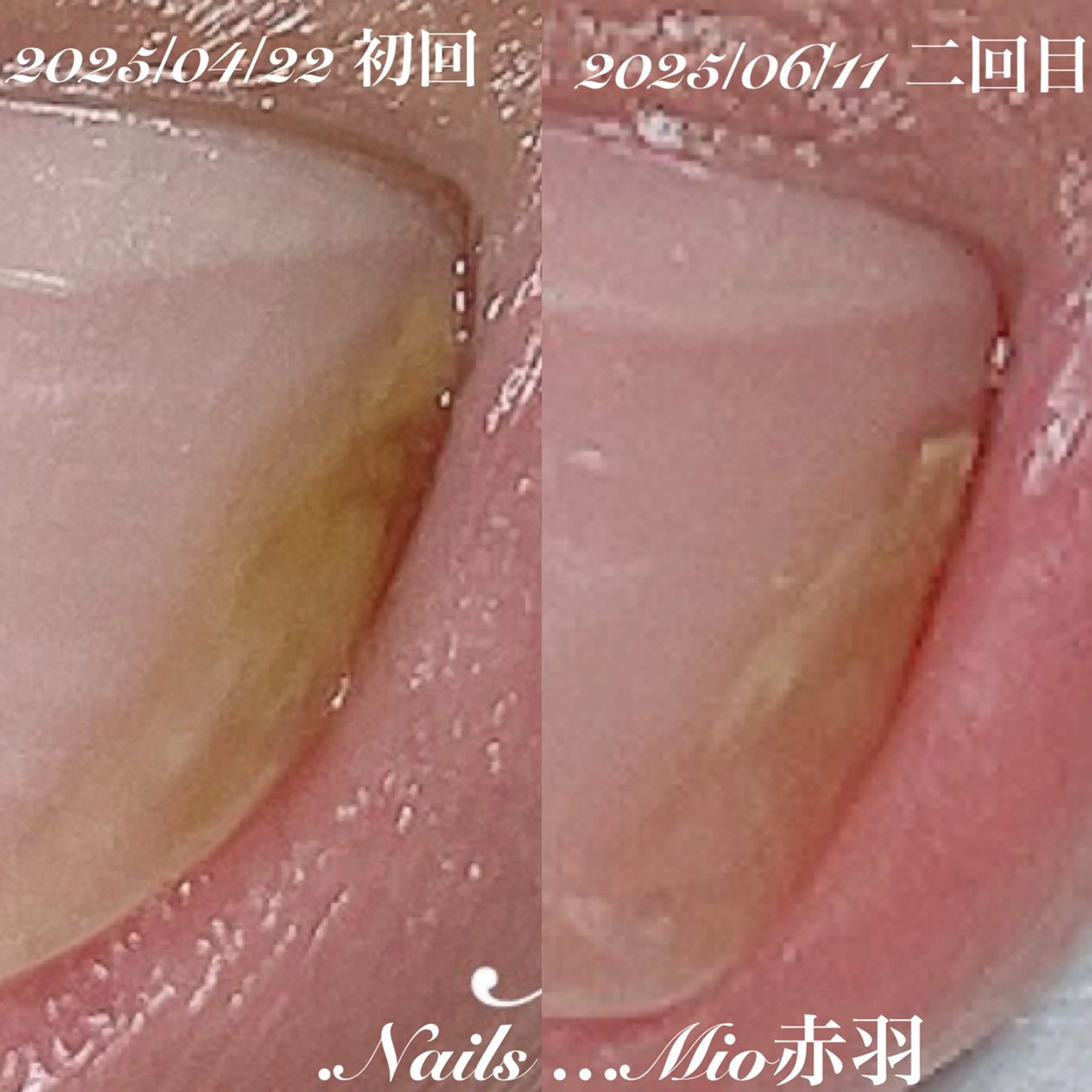 ネイル フットネイル ジェルネイル .Nails Mio 赤羽西ネイルサロンのネイルデザイン