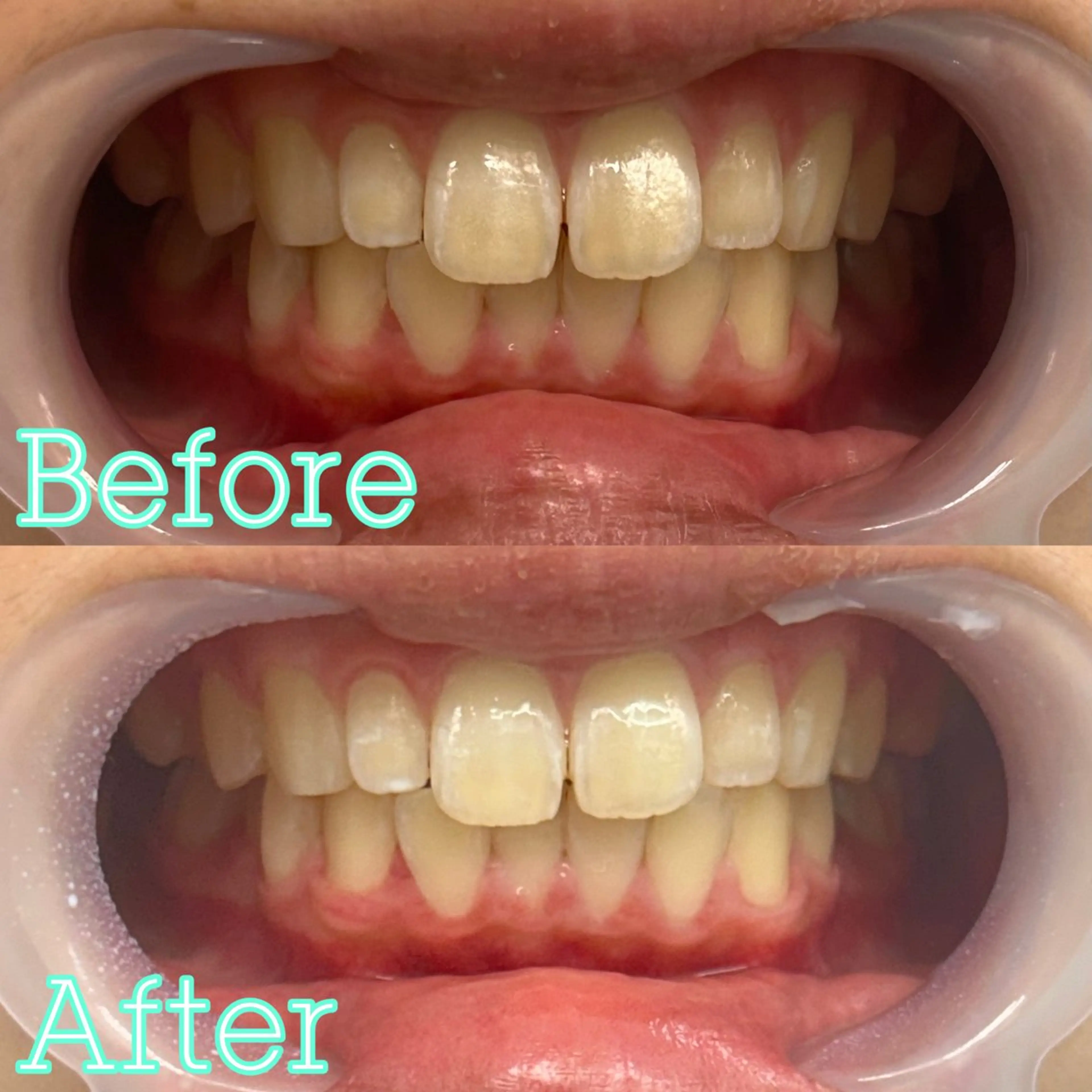 歯のホワイトニング専門店 MIGAQ 京都四条大宮店所属・佐藤 未来の眉毛・アイブロウイメージ