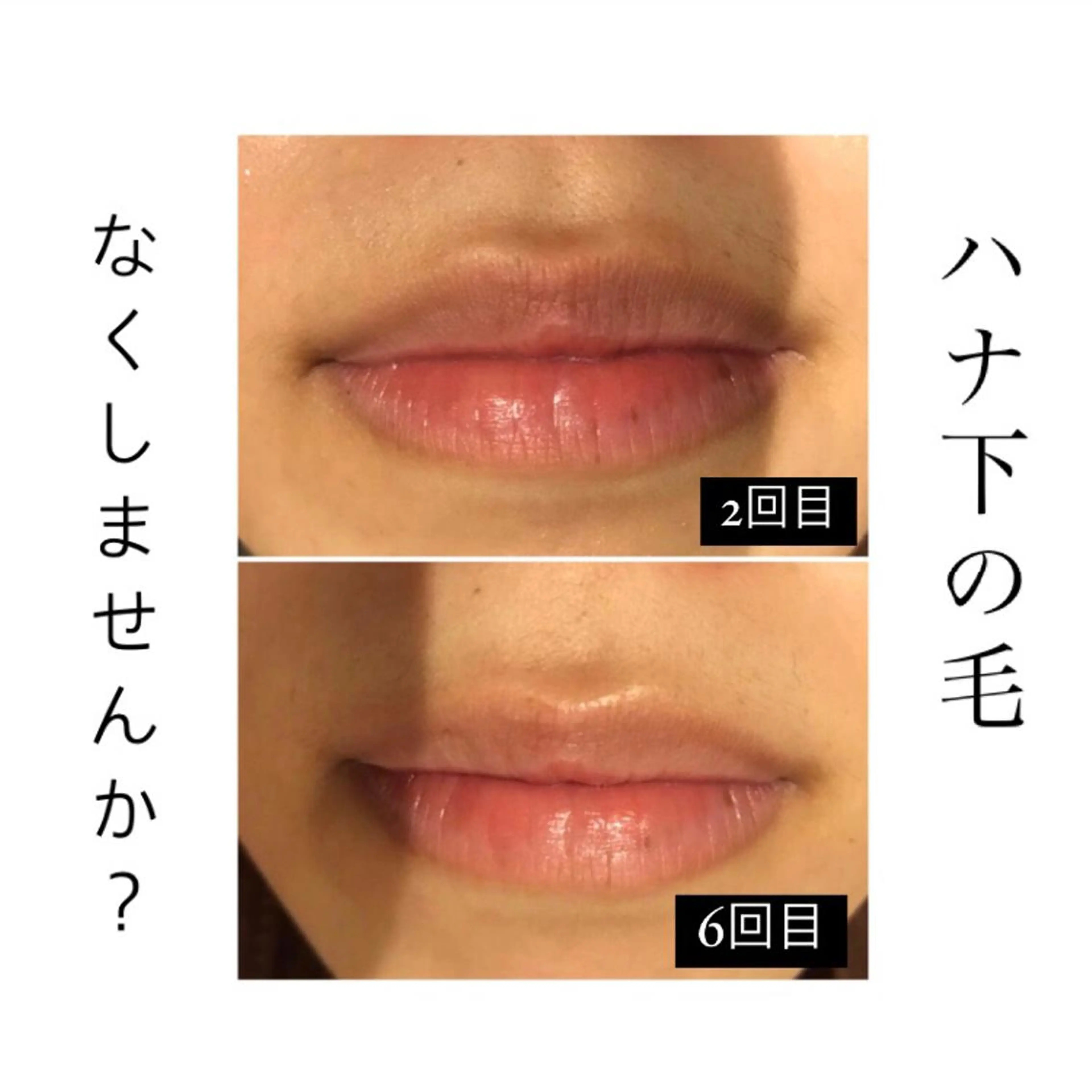 美肌脱毛専門サロン Dione栄店のエステ・リラクイメージ