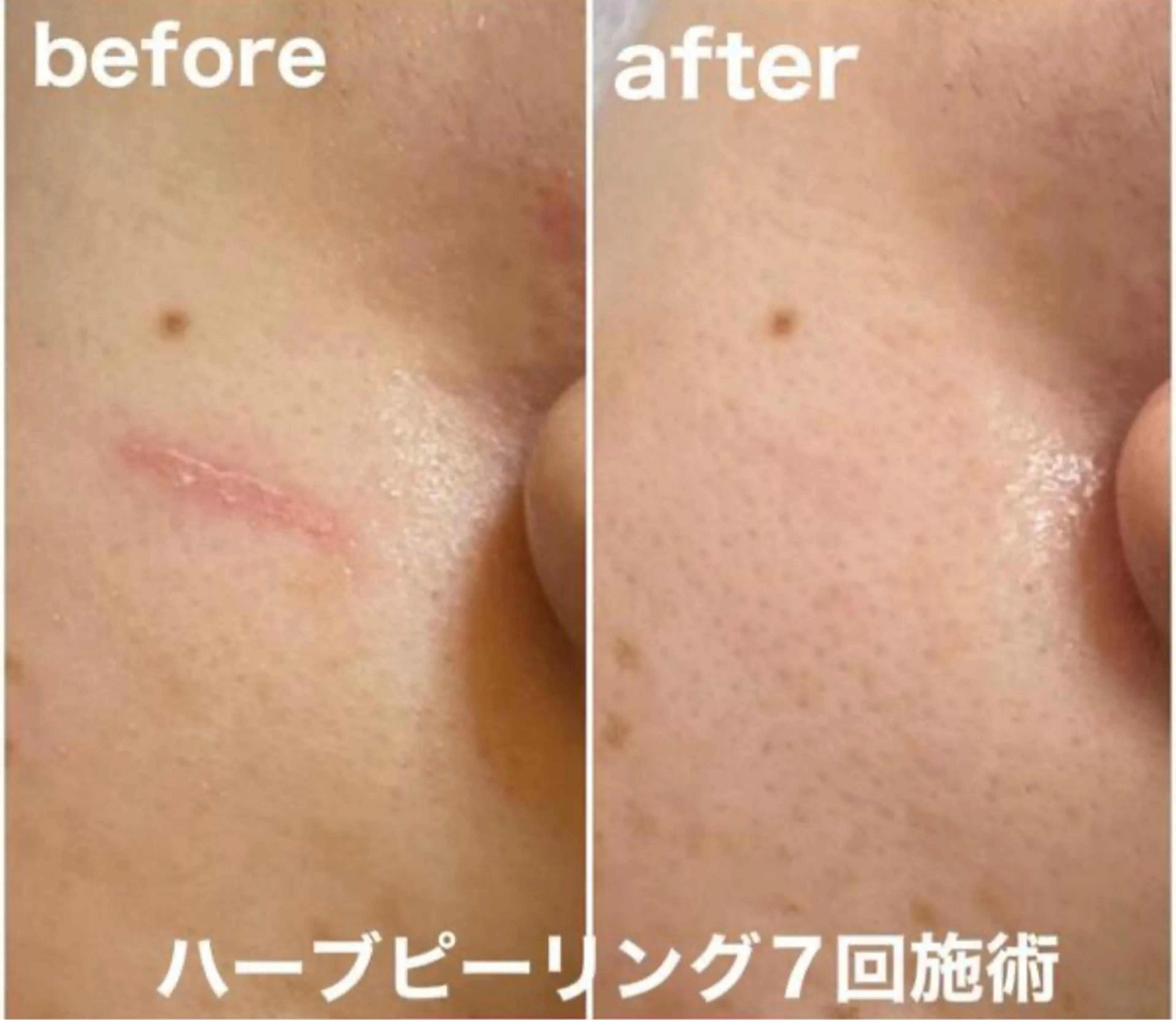 Belle原宿所属・佐藤 加奈のエステ・リラクイメージ