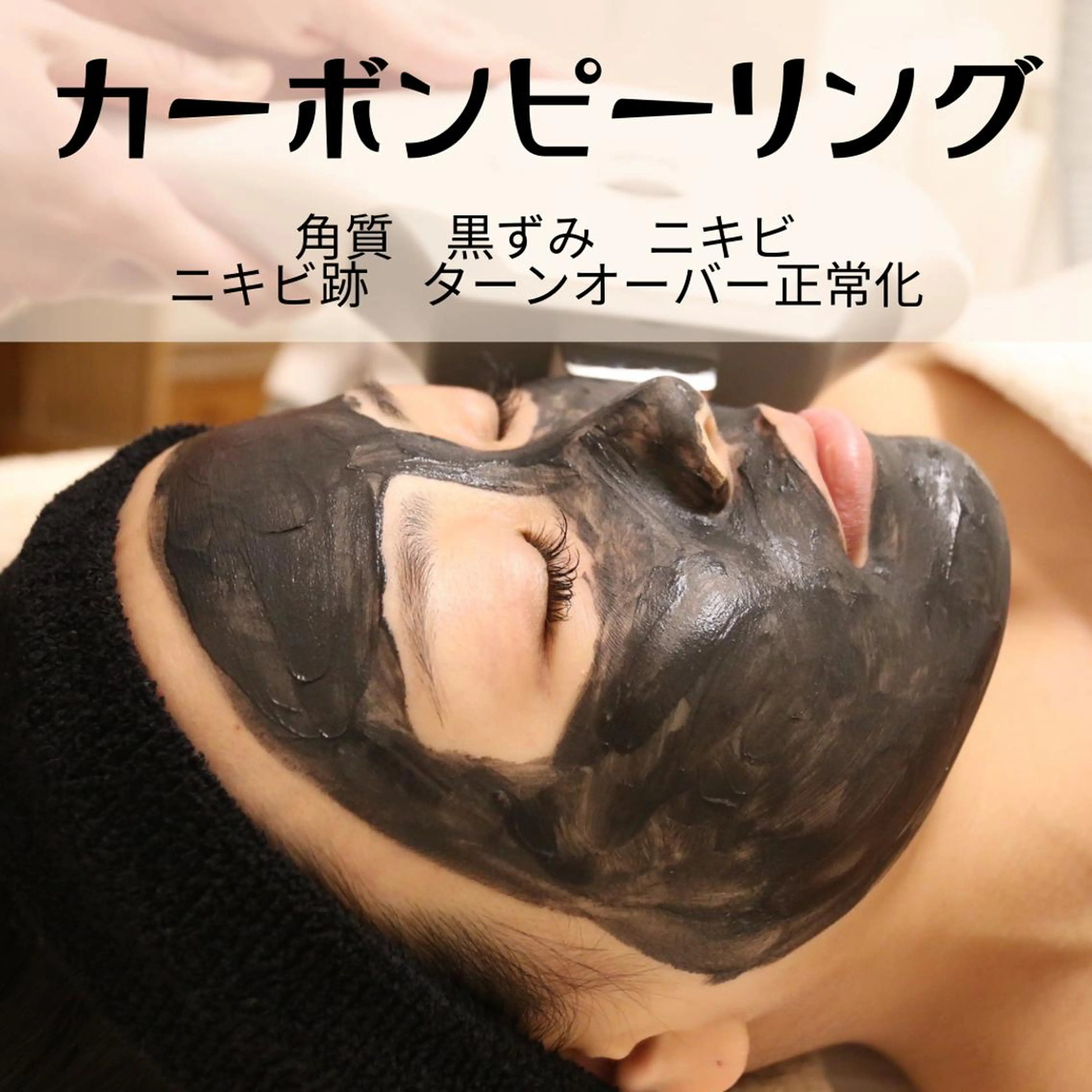 夏の脂性肌にカーボンピーリング🖤『肌の凹凸 角質除去 ニキビ 黒ずみ』敏感肌でも可能￥6600円→3300円の写真