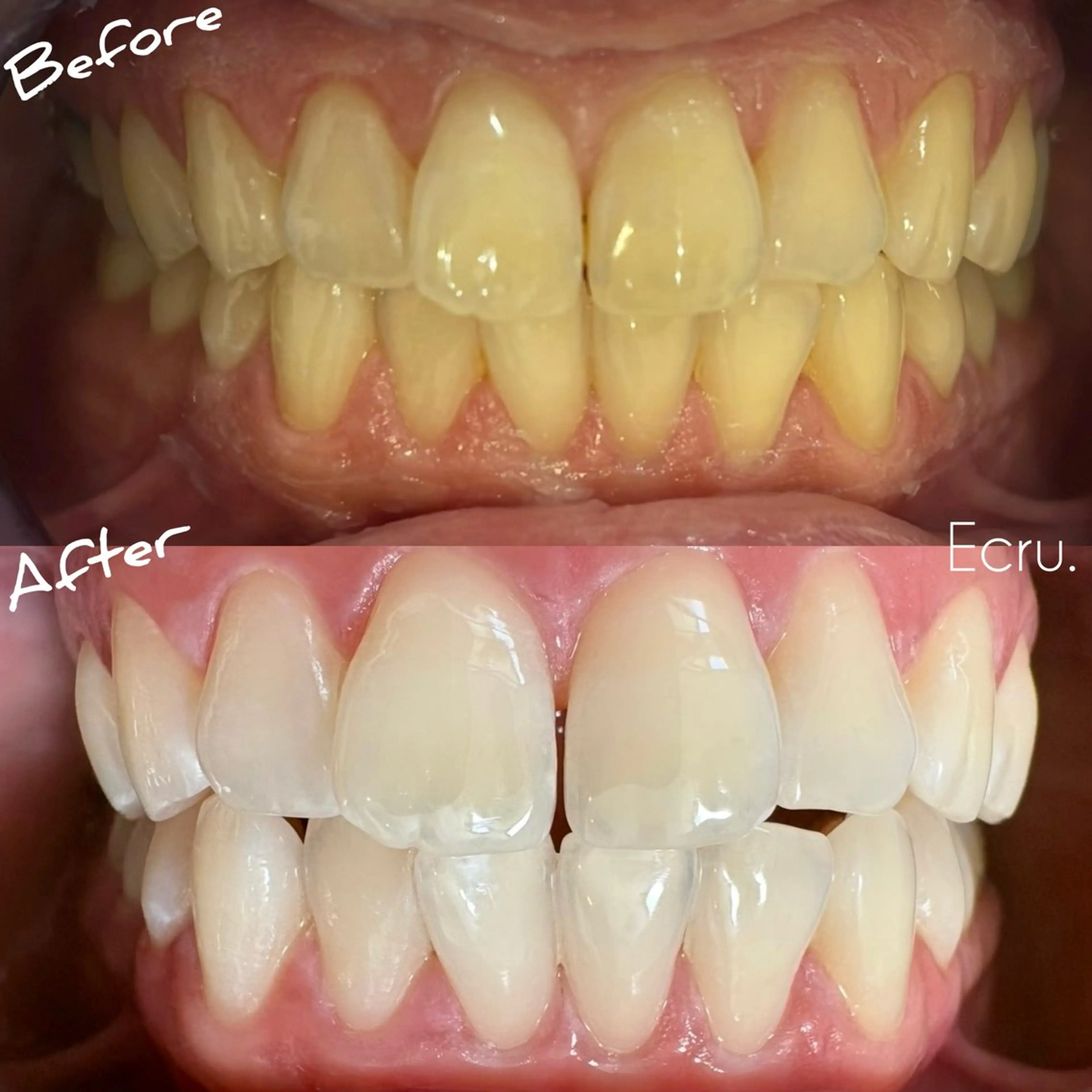 メンズ キッズ エステ ホワイトニングサロン Ecru所属・ホワイトニングサロン Ecru エクリュのその他イメージ