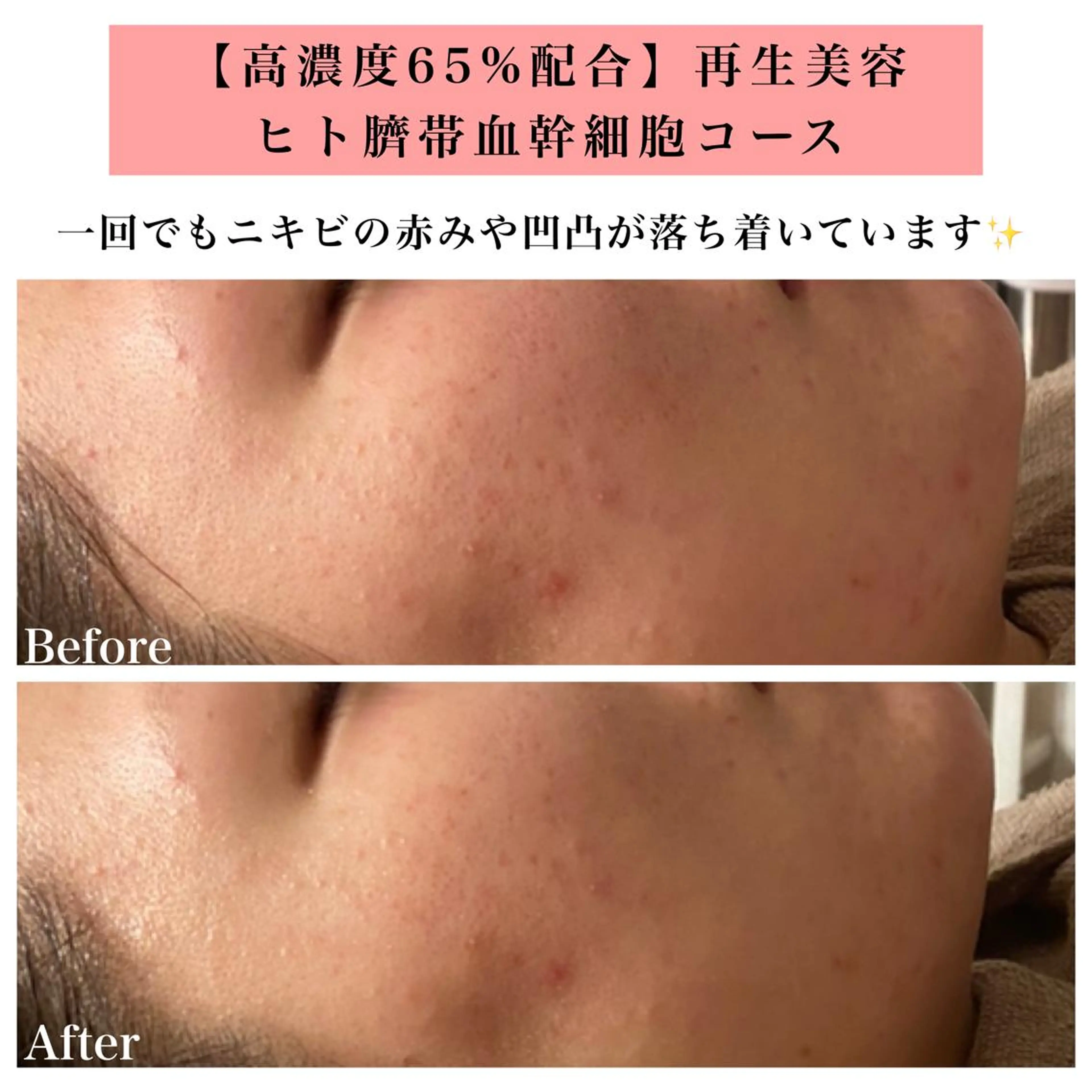 エステ リラク Bellesthe （ベルエステ）のエステ・リラクイメージ