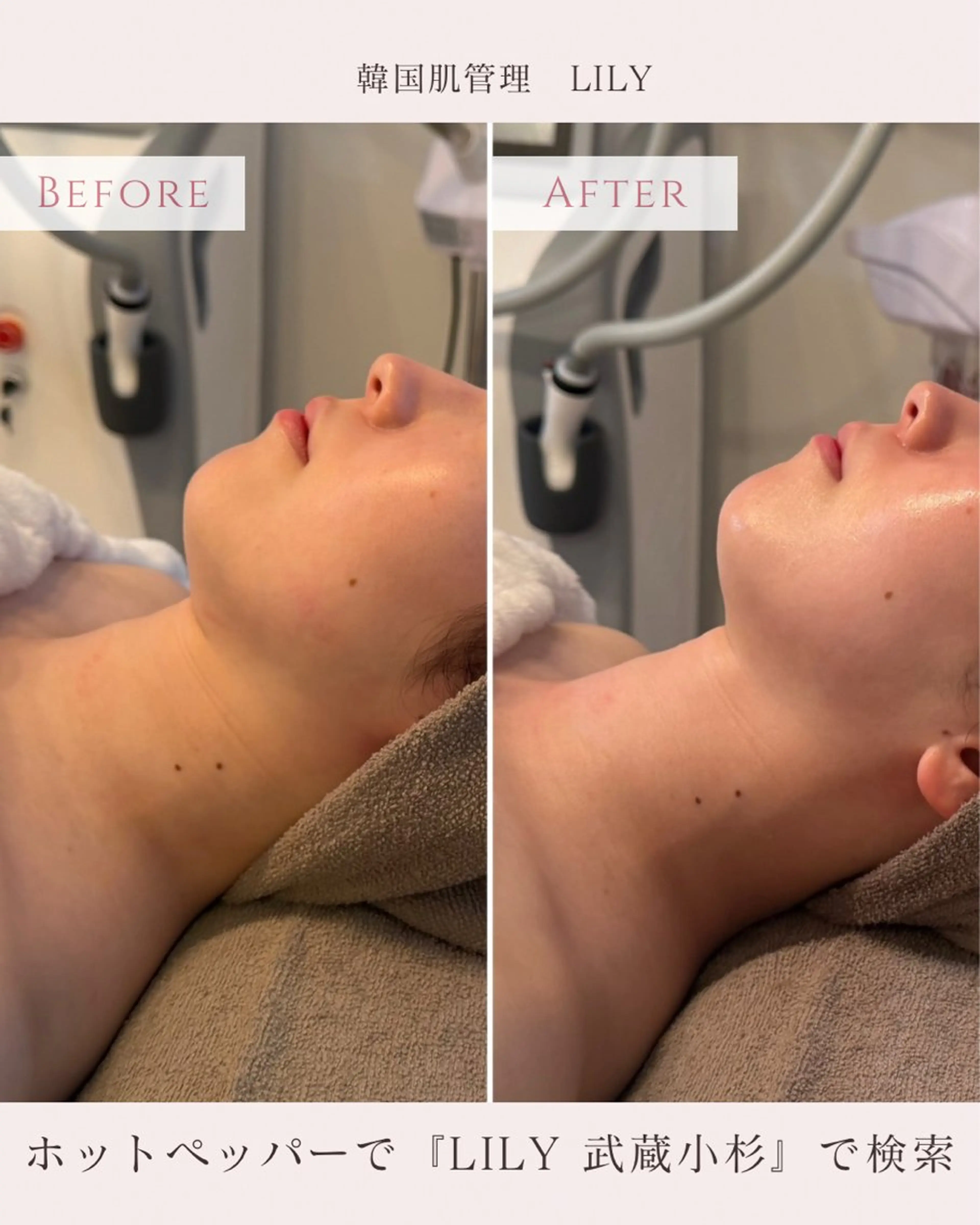 エステ LILY所属・KAORU .のエステ・リラクイメージ