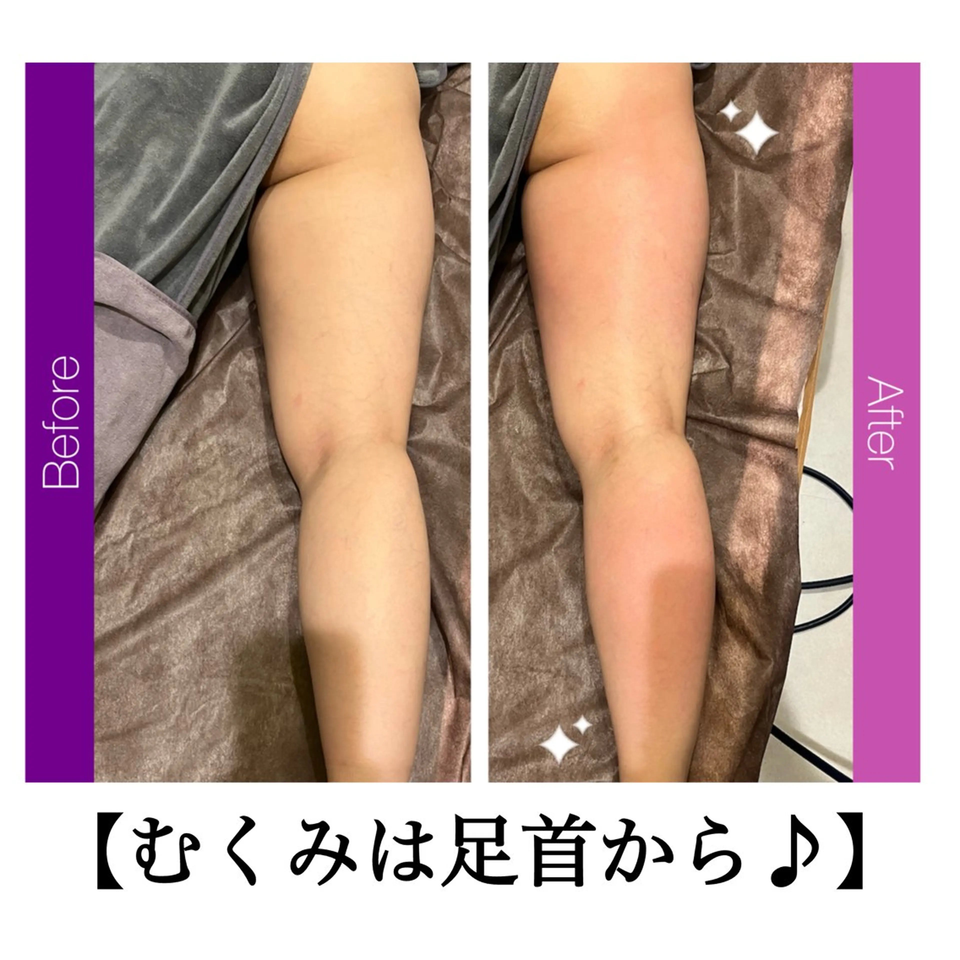 ☆痩身/小顔☆ 結果出します☆のエステ・リラクイメージ