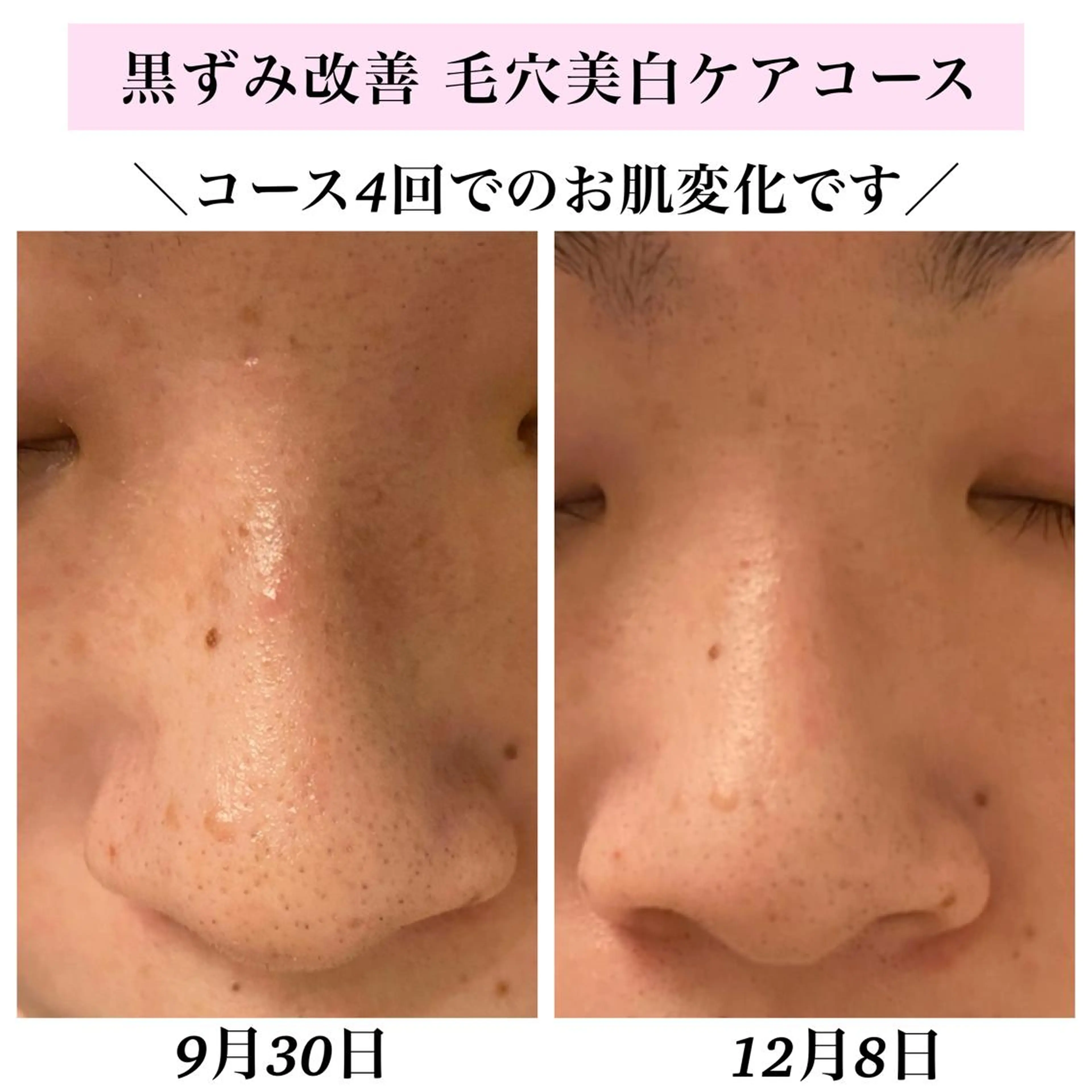 エステ リラク Bellesthe （ベルエステ）のエステ・リラクイメージ