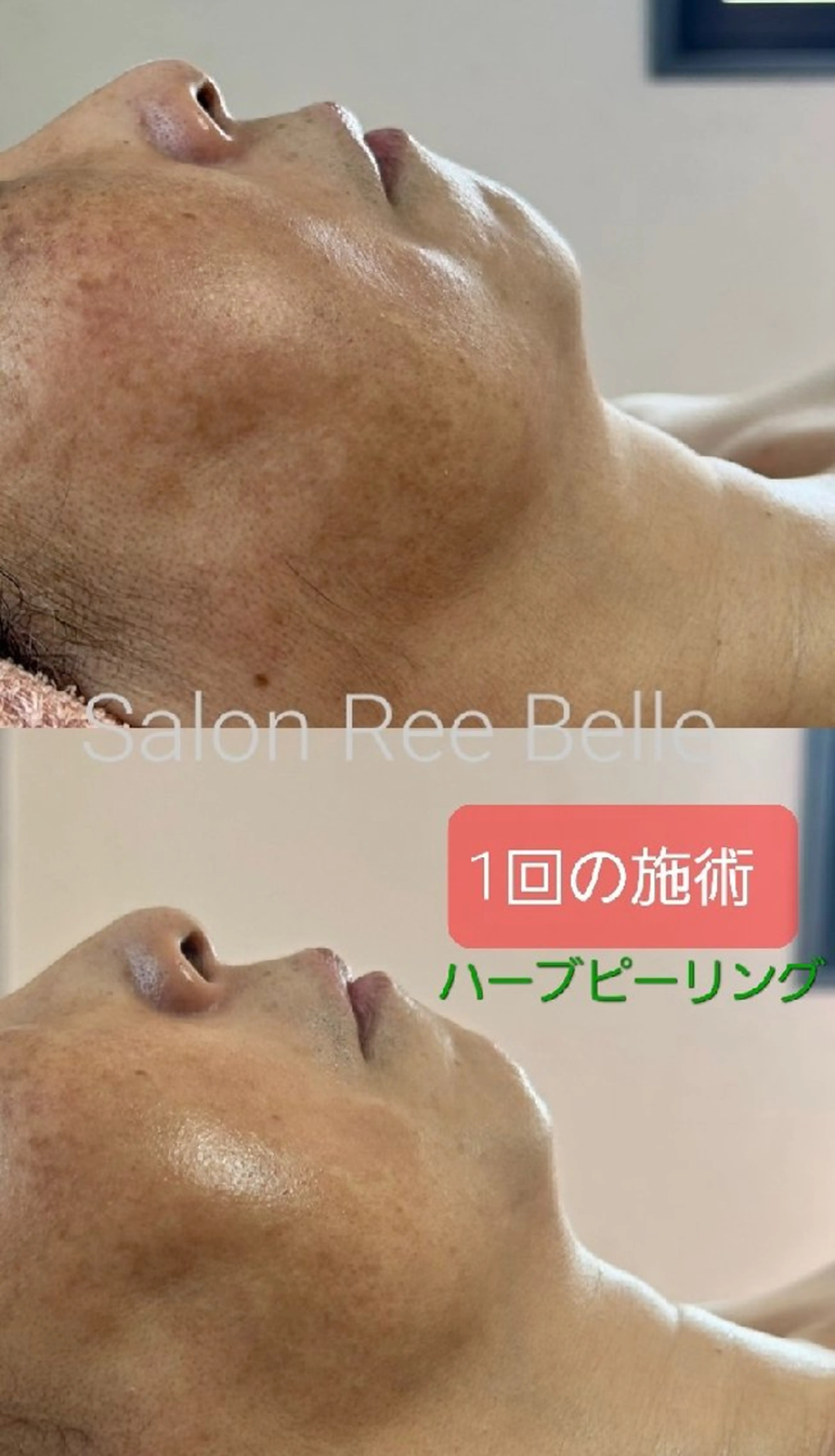 Salon Ree Belle(サロン リベル)所属・サロン リベル YUKAのエステ・リラクイメージ