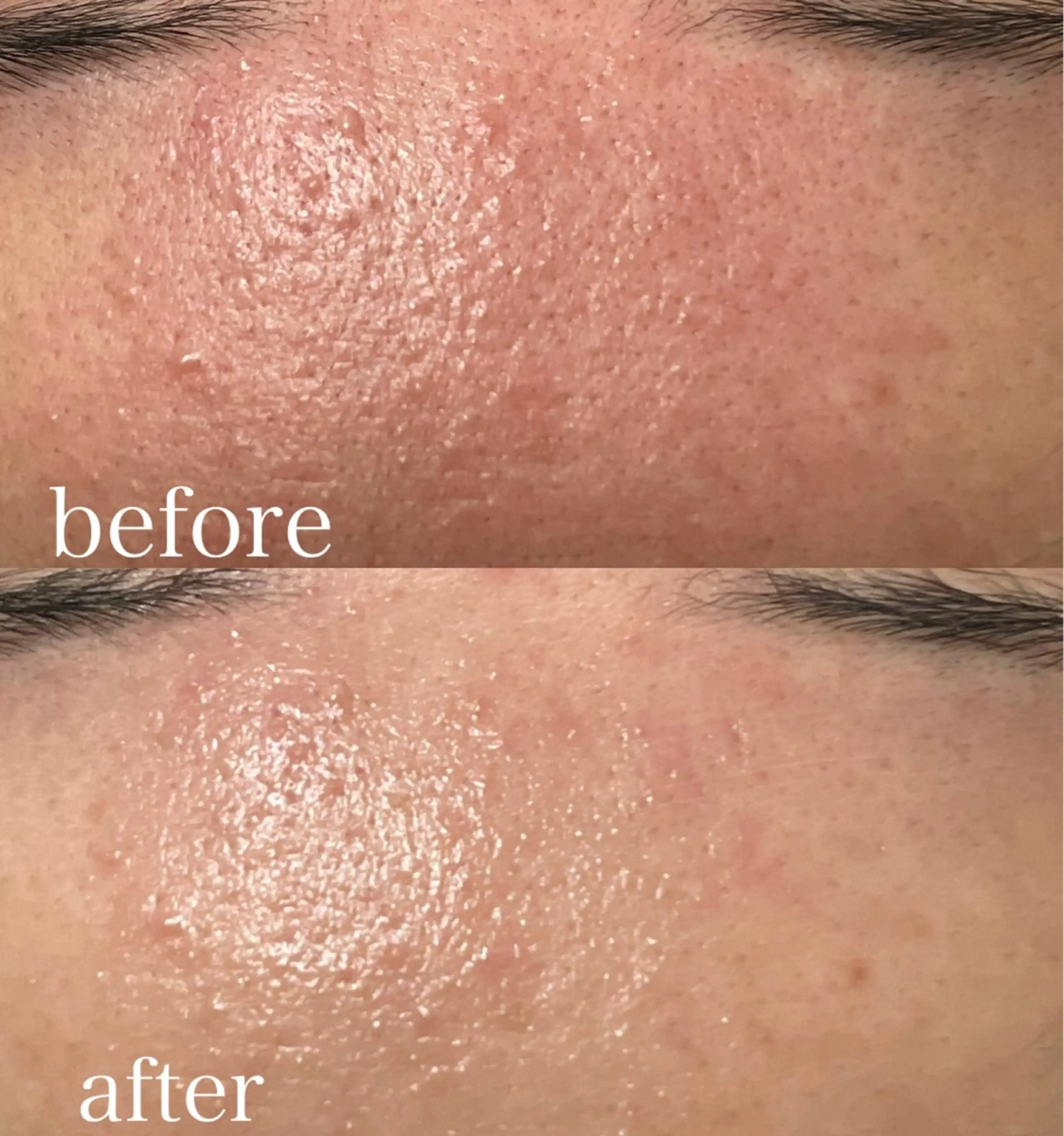 Beauty   Salon  Adiy所属・Adiy ikumiのエステ・リラクイメージ