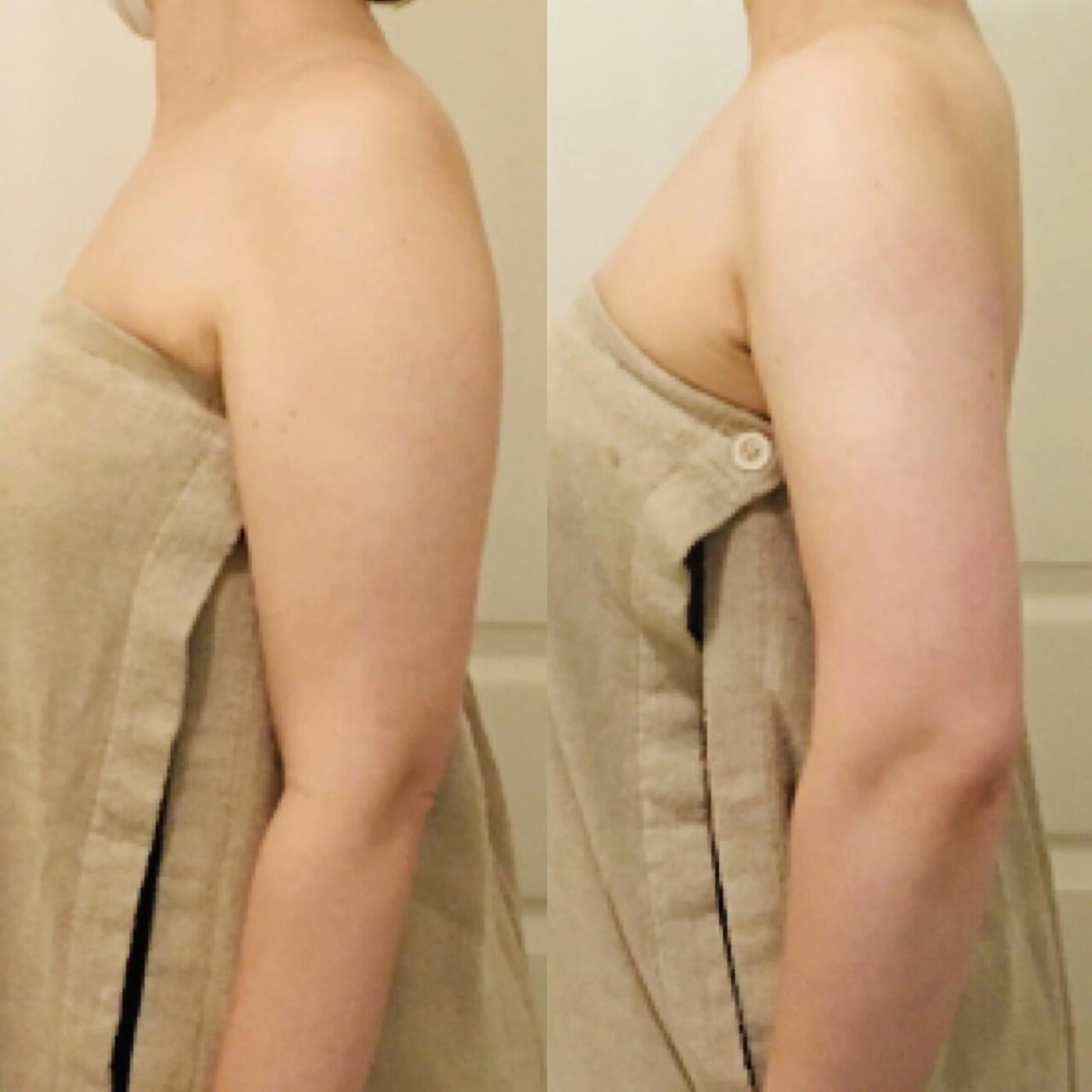 痩身ハイパーナイフ 小顔フェイシャル痩身のエステ・リラクイメージ