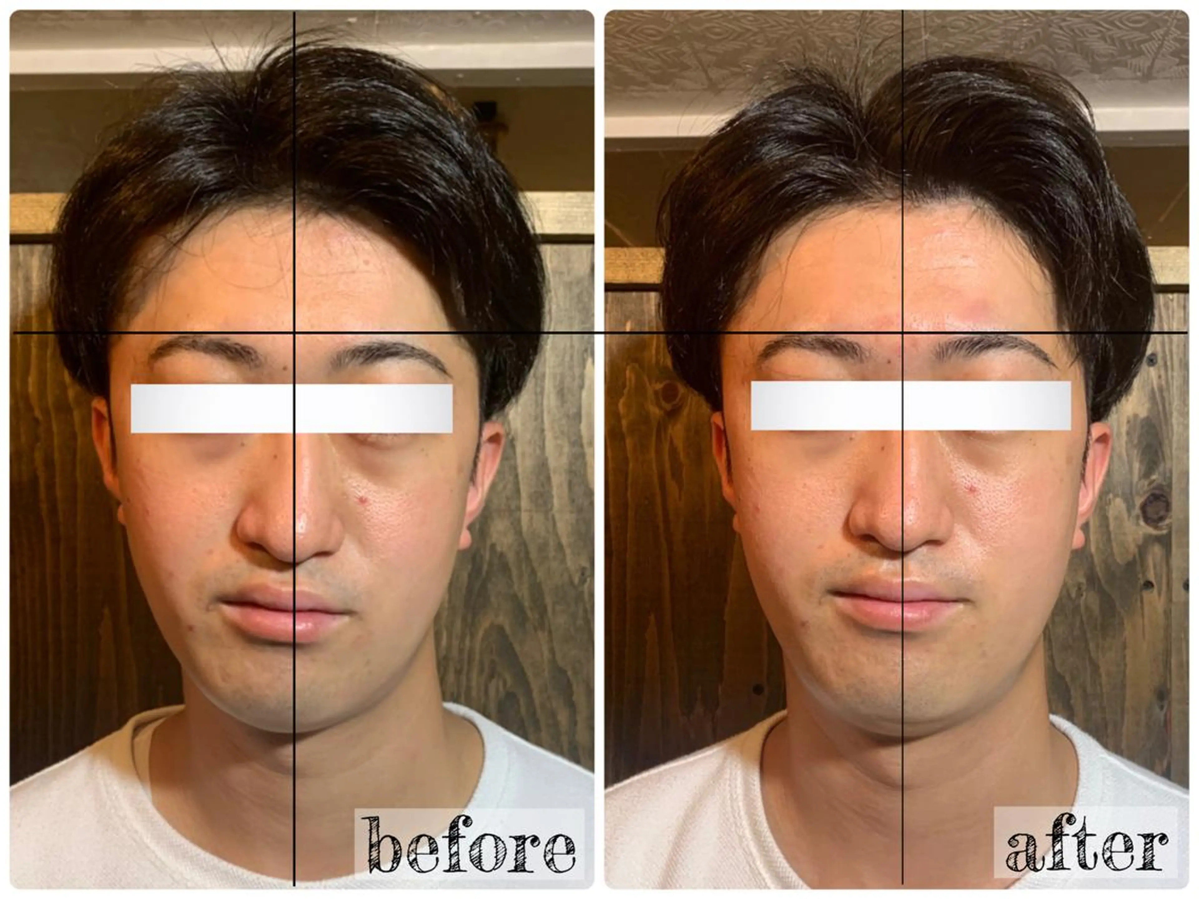 エステ リラク 💎後悔させない小顔 矯正💎イトヤマ🌱のエステ・リラクイメージ