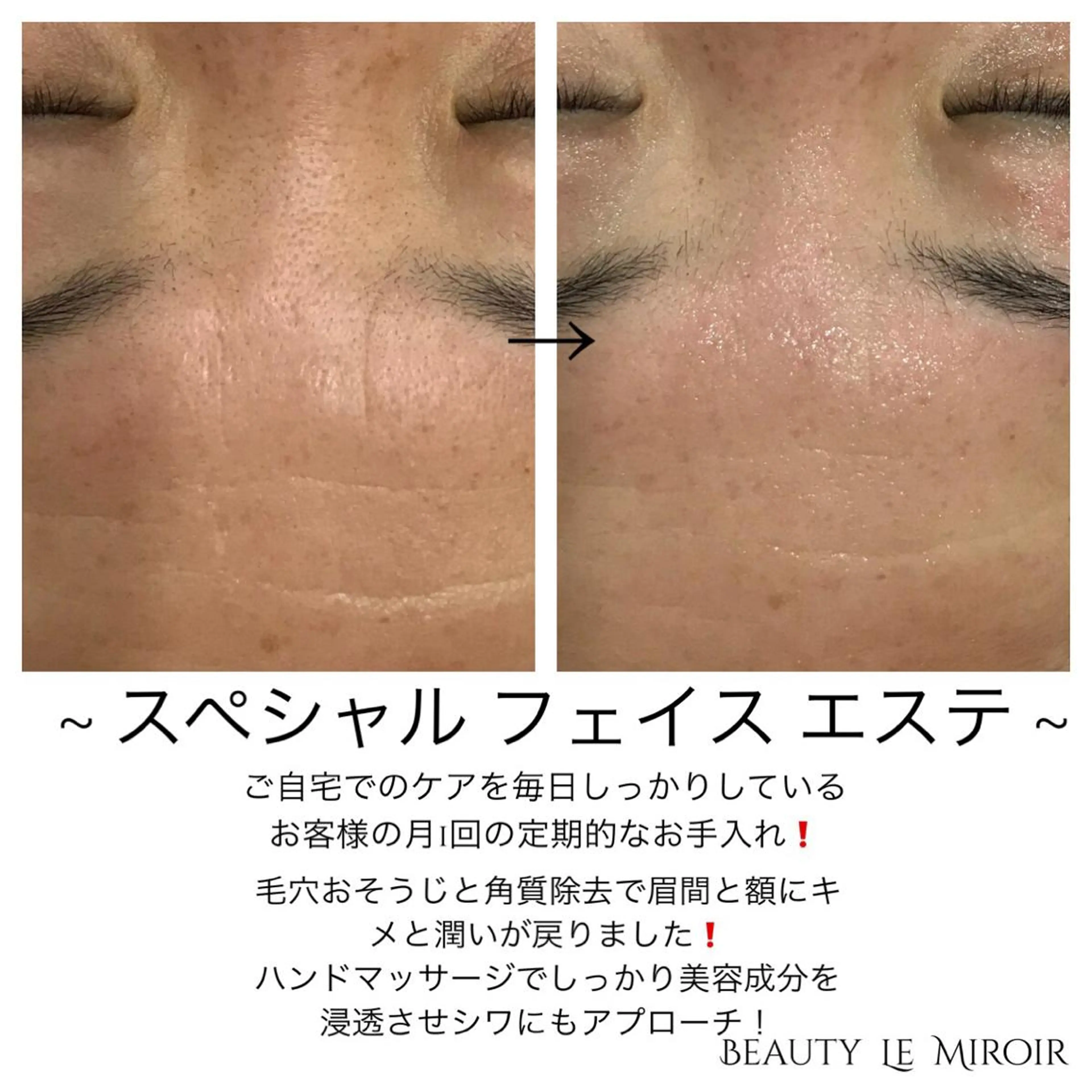 ビューティー ミロワールのエステ・リラクイメージ