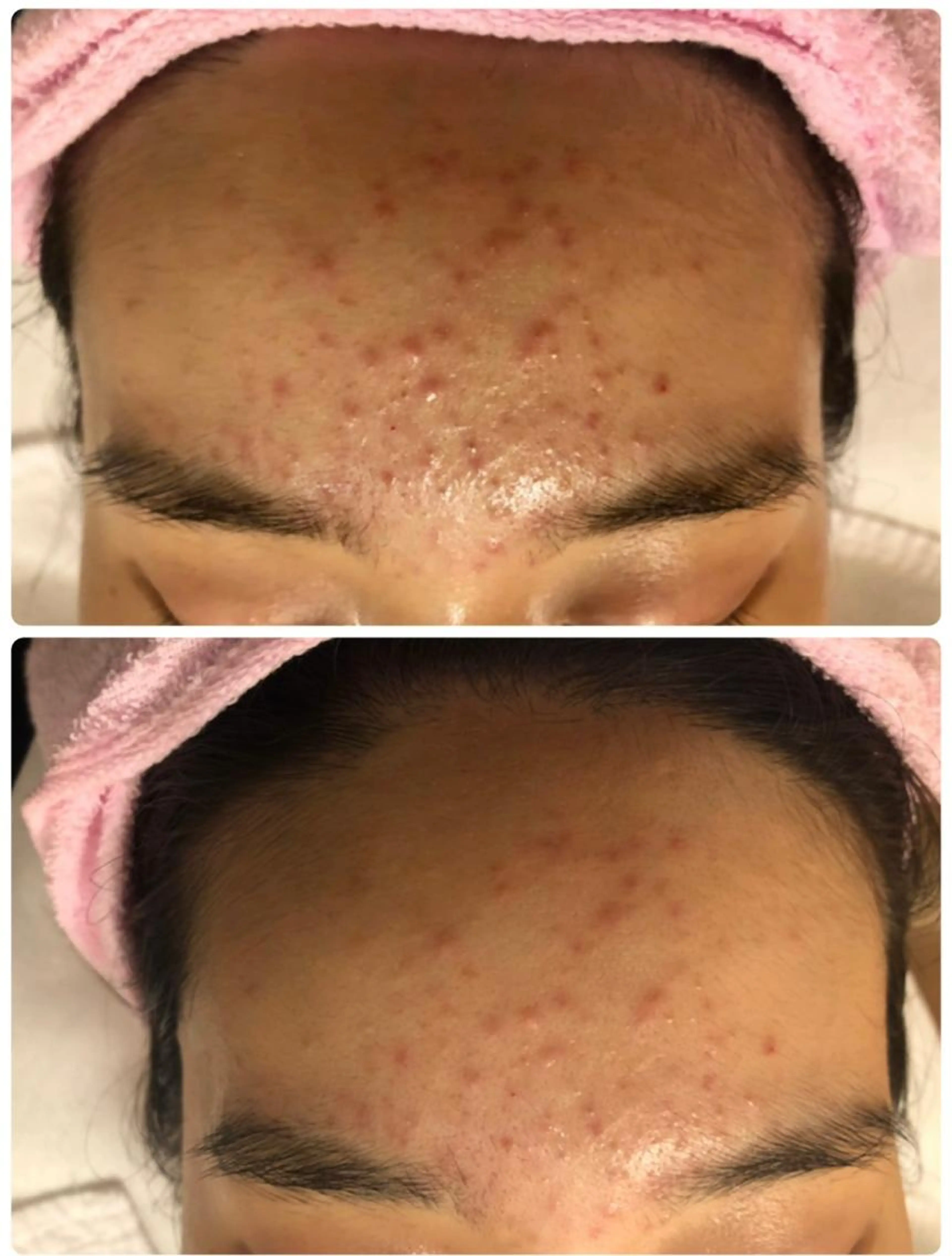 【人気No.1👑】🌿ビタミン補充エステ🌿クレンジング→スチームマッサージ→タラソパック→スキンケア→お仕上げの写真