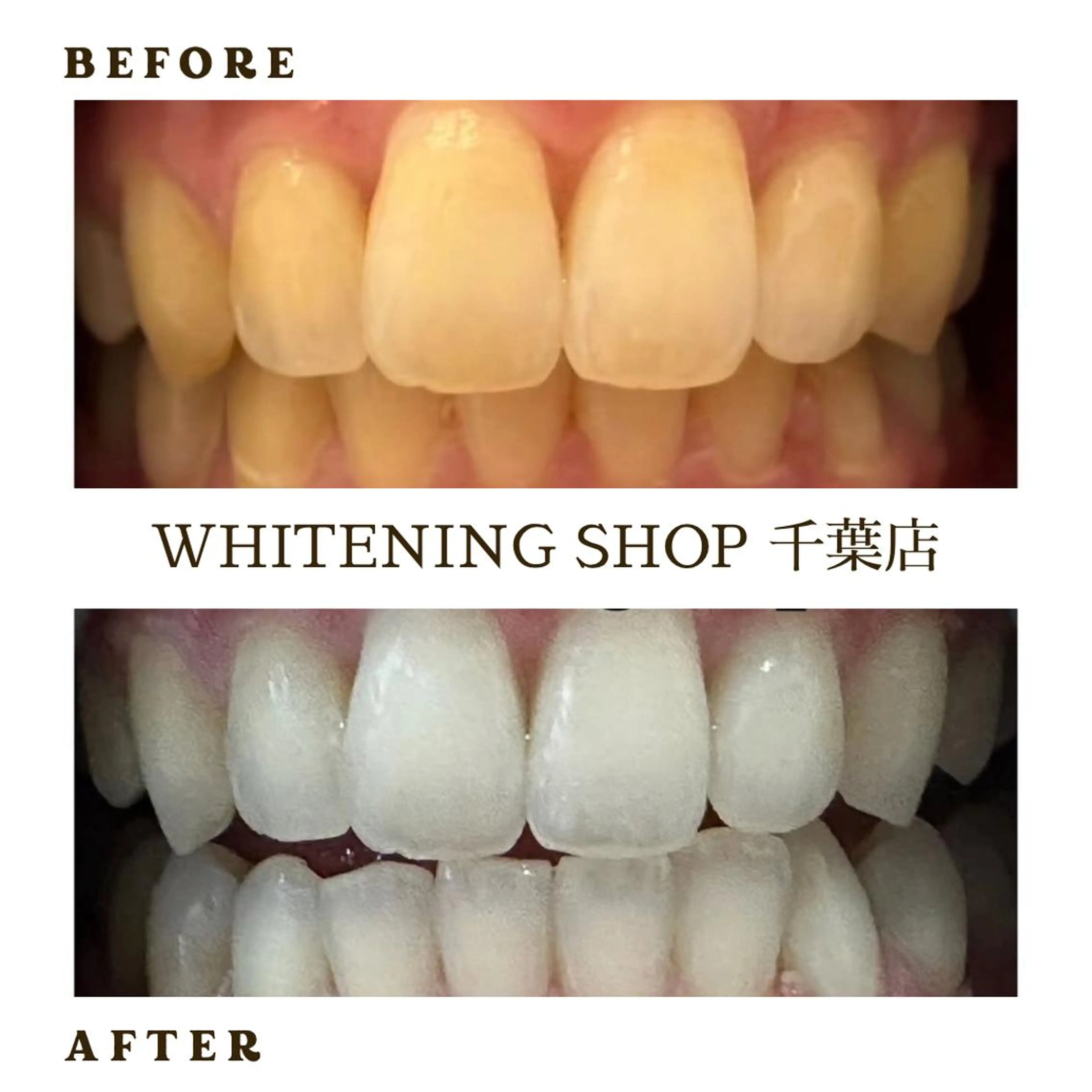 メンズ 学生（メンズ向け） ホワイトニング ショップ千葉店のその他イメージ