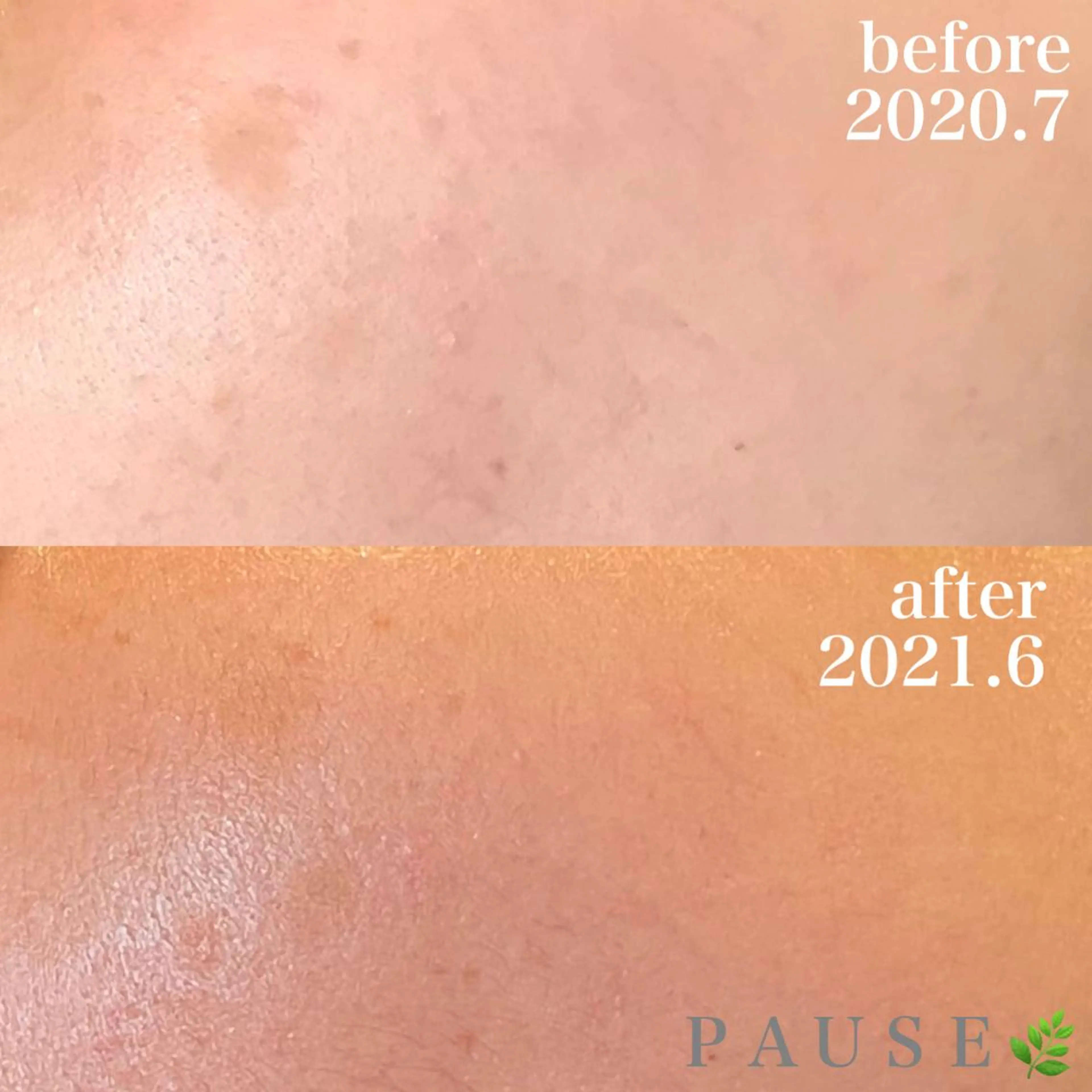 エステ 浜野 恵美のエステ・リラクイメージ