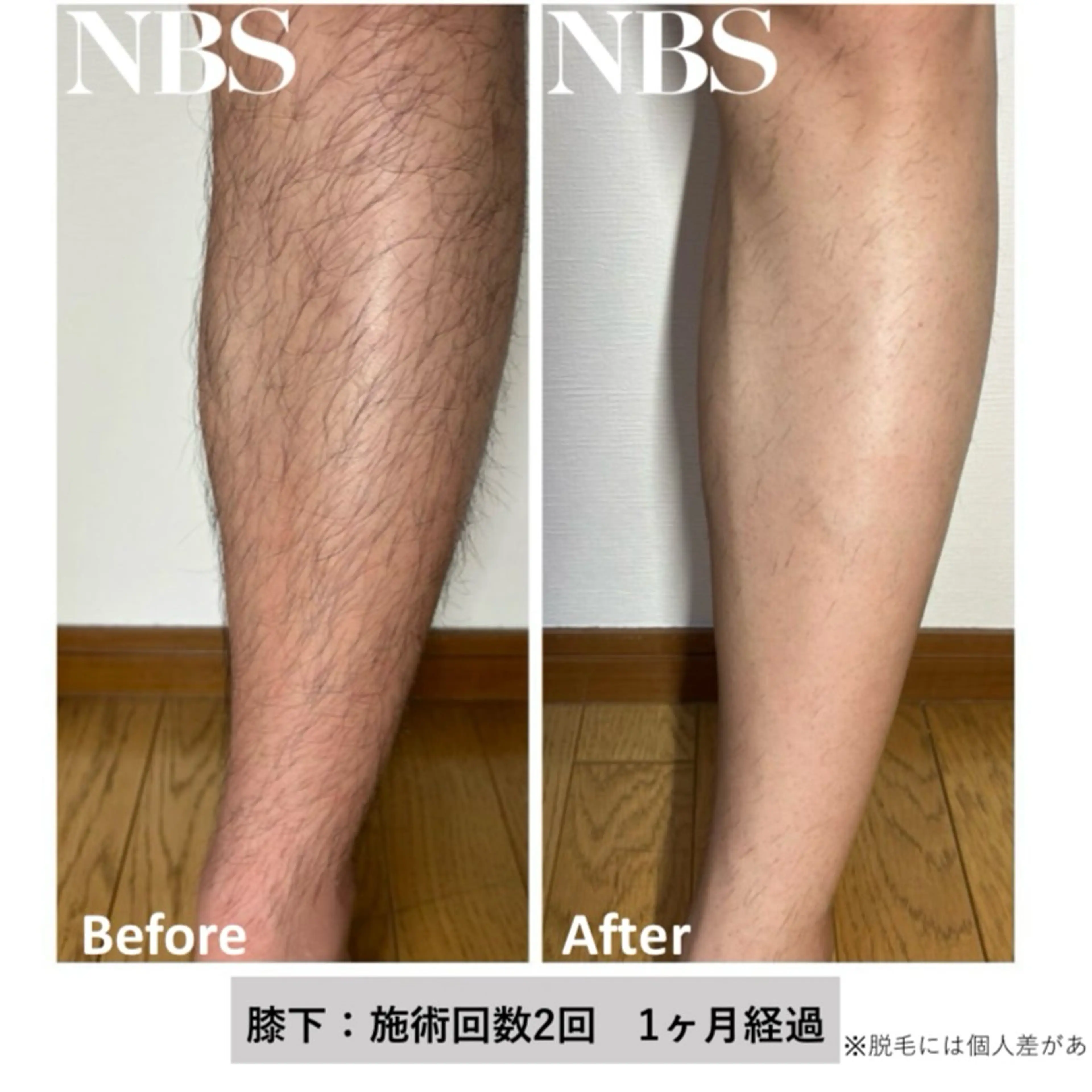 メンズ トータルビューティー サロン　Lisseの眉毛・アイブロウイメージ