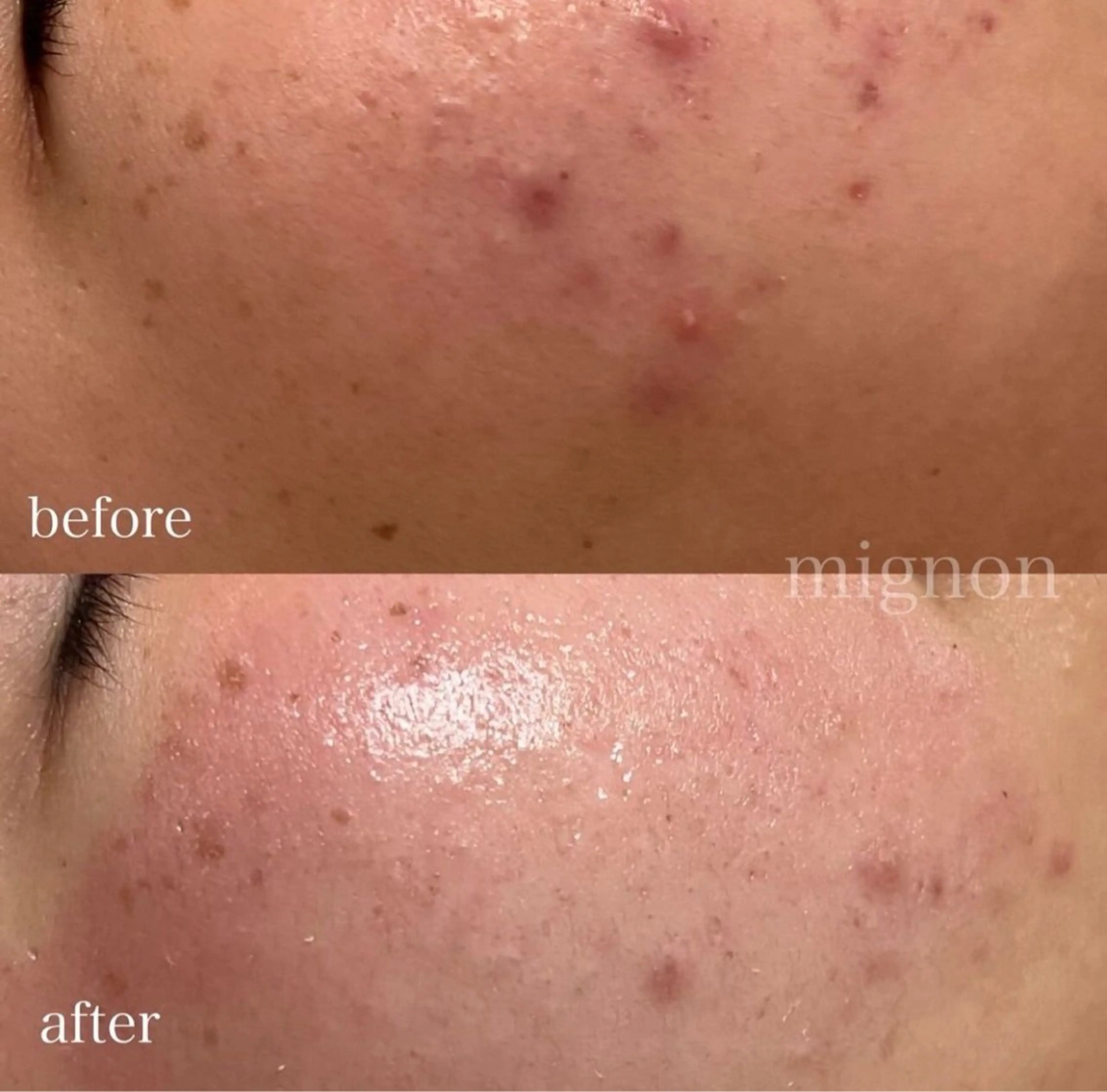 、 、‪‪のエステ・リラクイメージ