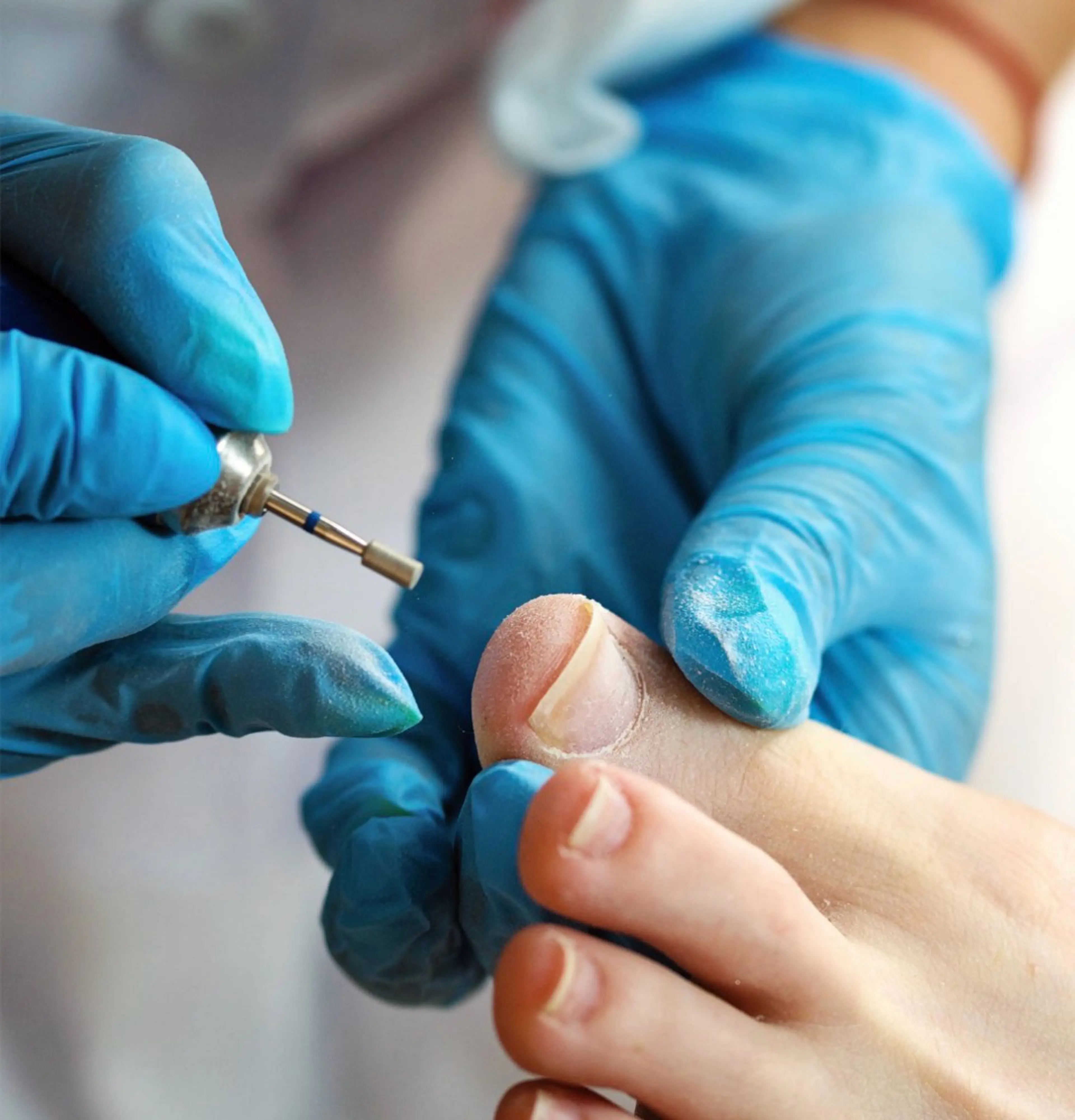 ネイル その他(ネイル) Earth Total Beauty Salon所属・アース　トータル ビューティサロンのネイルデザイン