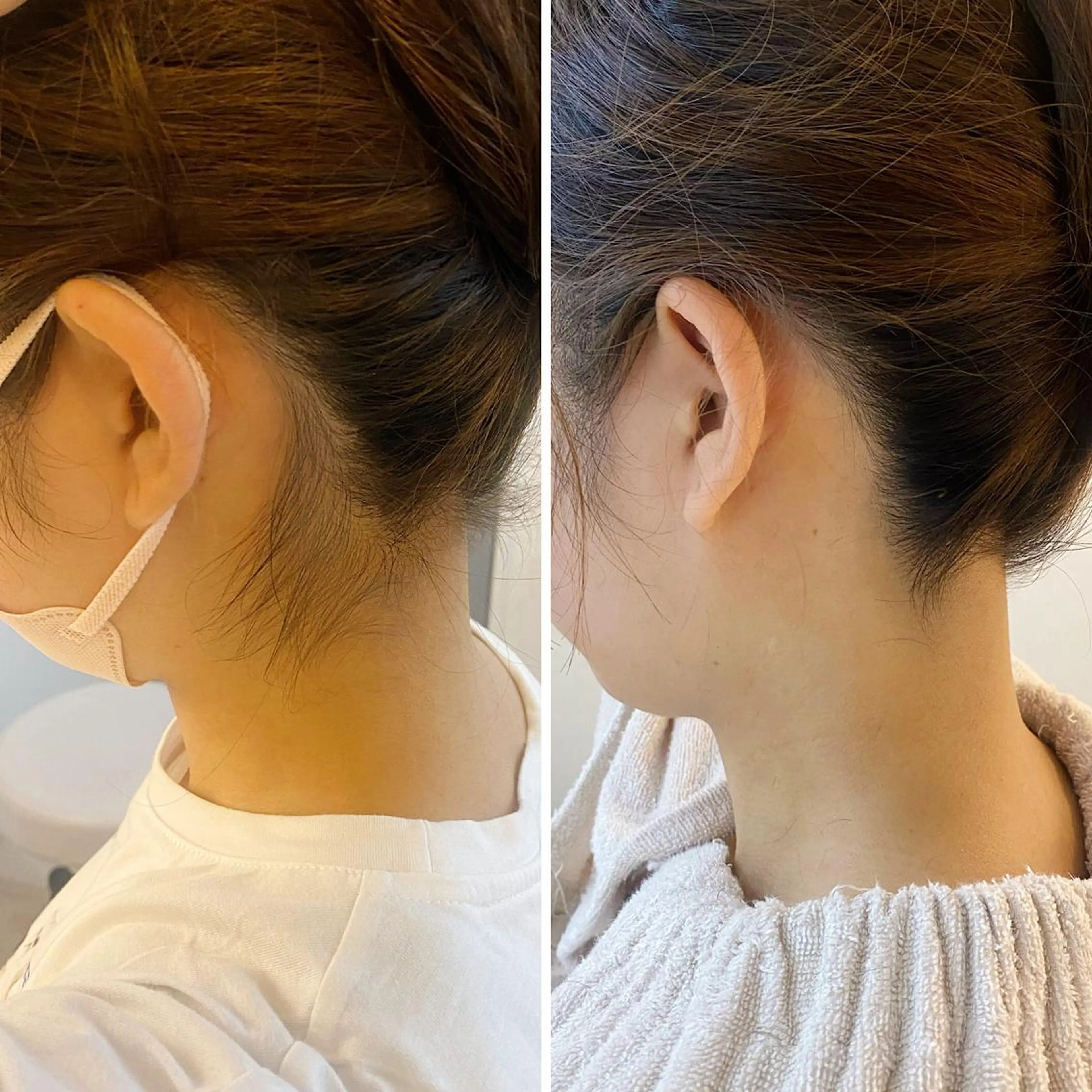 脱毛 うなじ脱毛/美肌脱毛 LABELのエステ・リラクイメージ