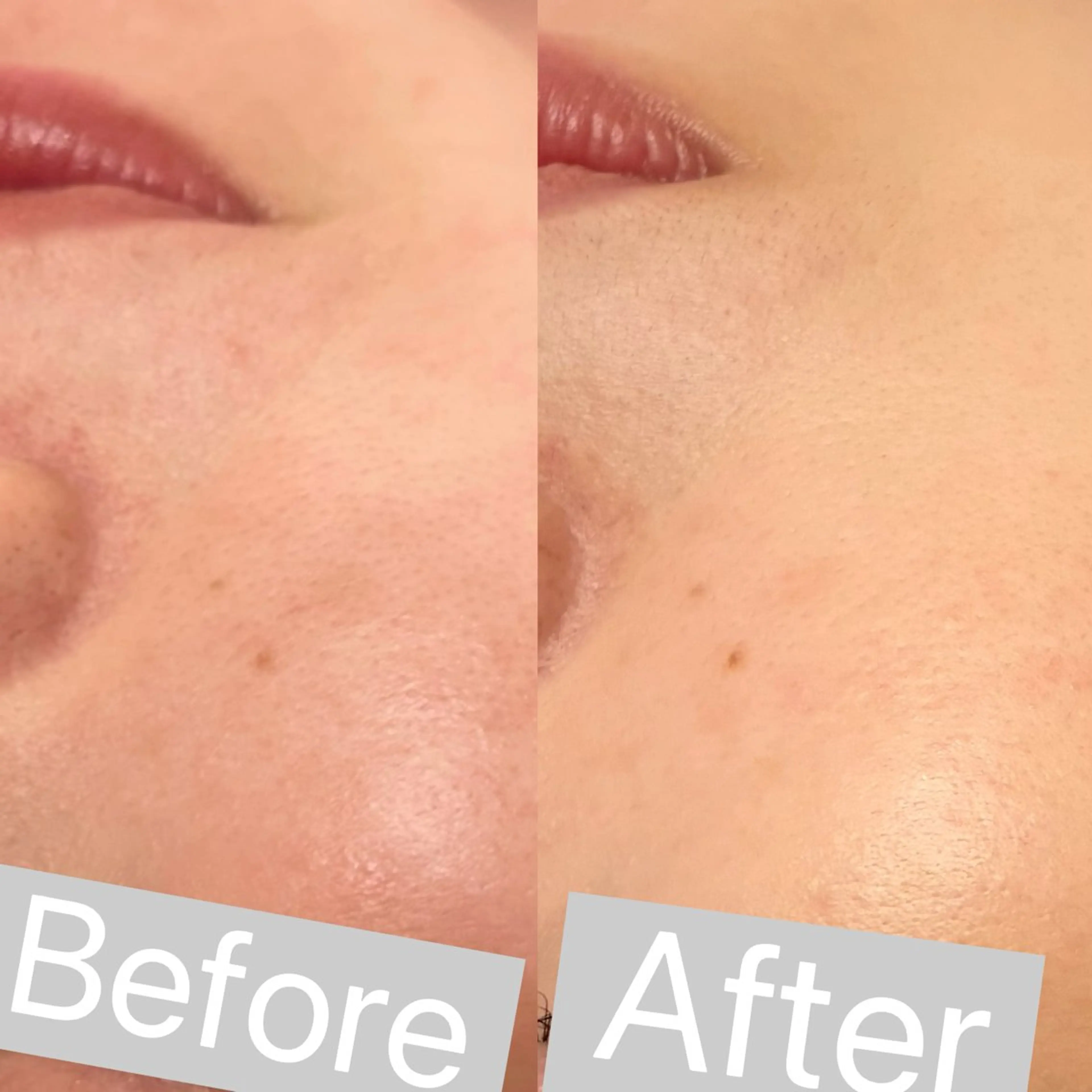 エステ アイラッシュ&エステサロンLinda西宮所属・小顔&毛穴・肌質改善 LINDA西宮 AIのエステ・リラクイメージ