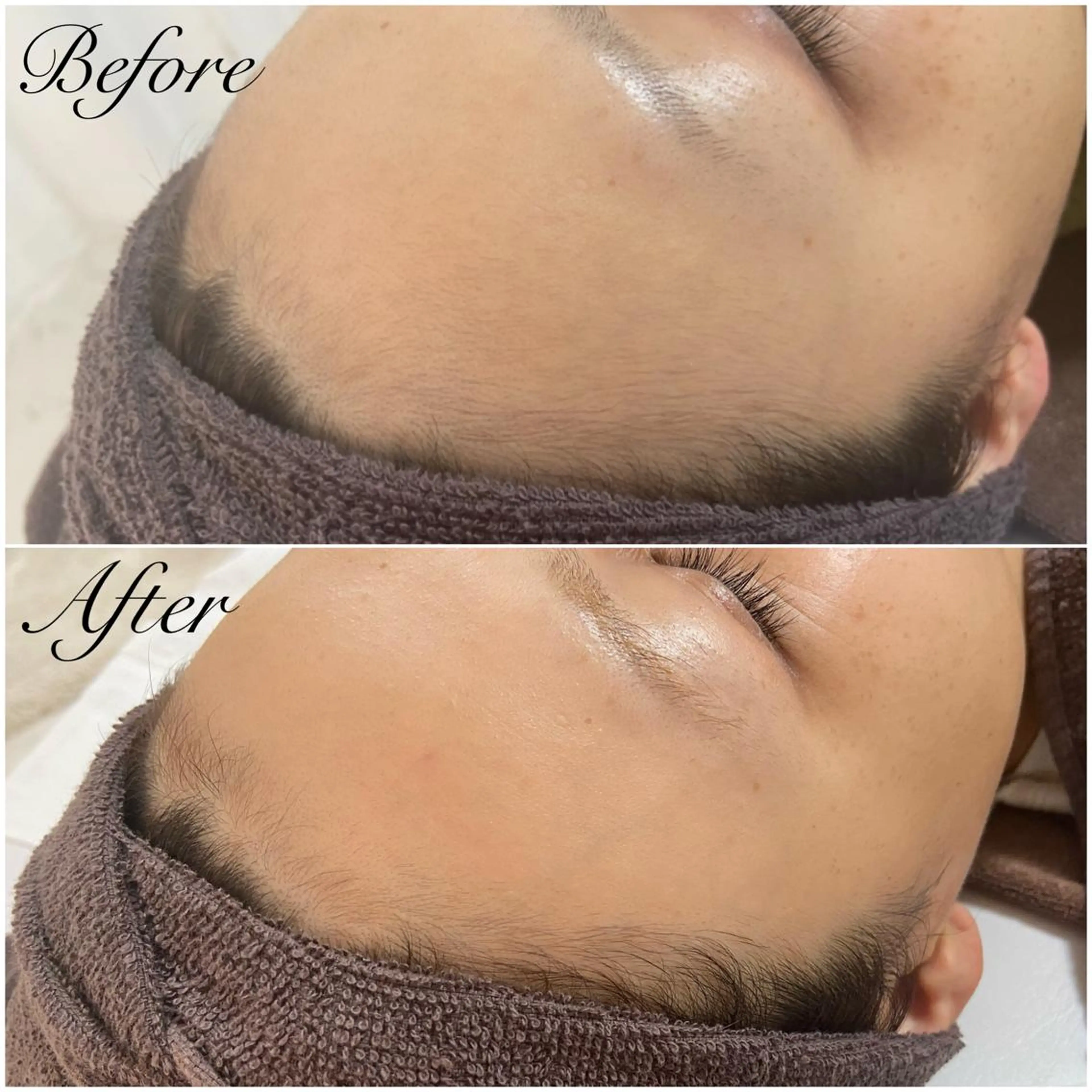 都度払い制脱毛サロンBe Charm所属・Be Charm 山﨑のエステ・リラクイメージ