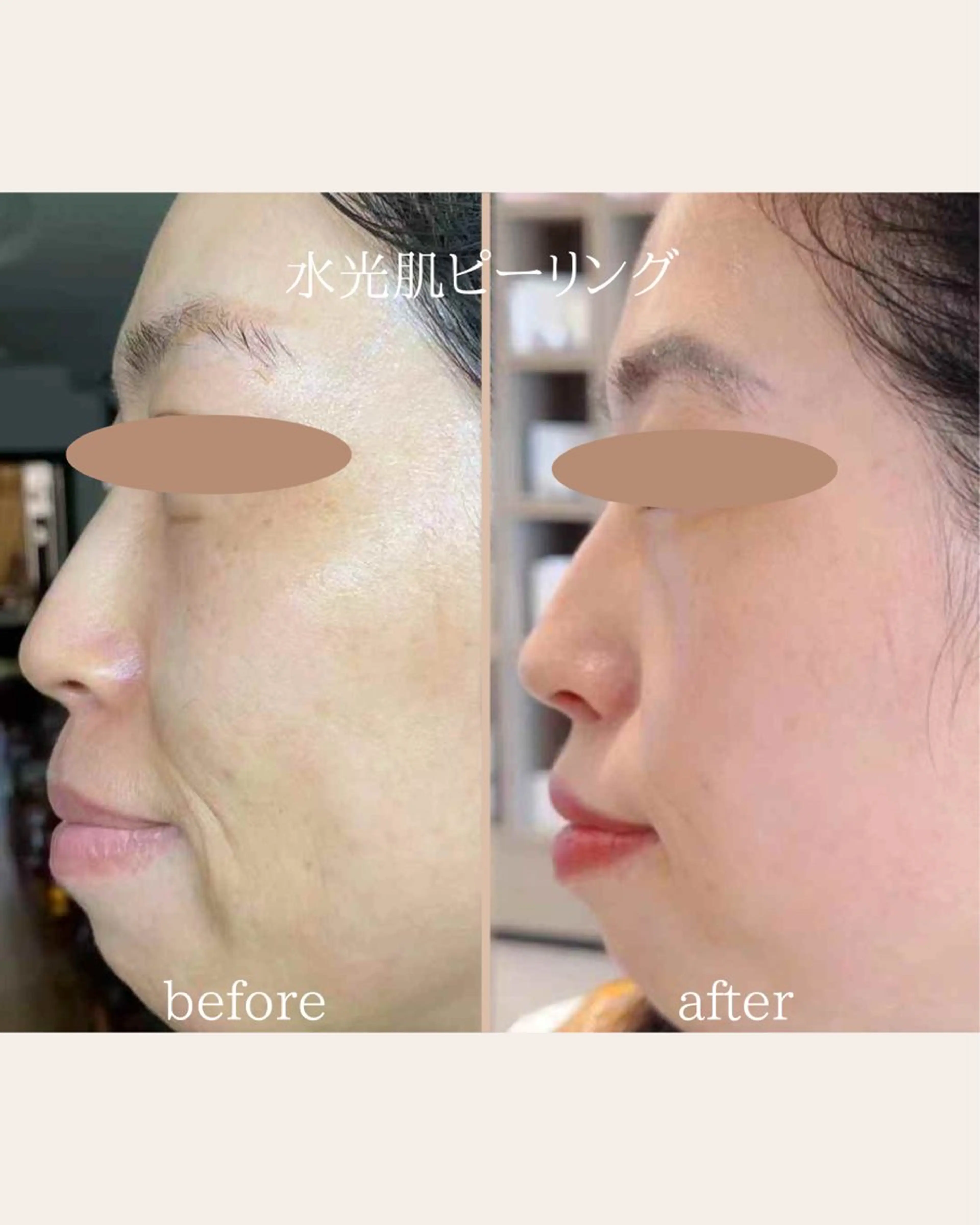 美腸サロン🌺 腸もみ/小顔/リンパのエステ・リラクイメージ