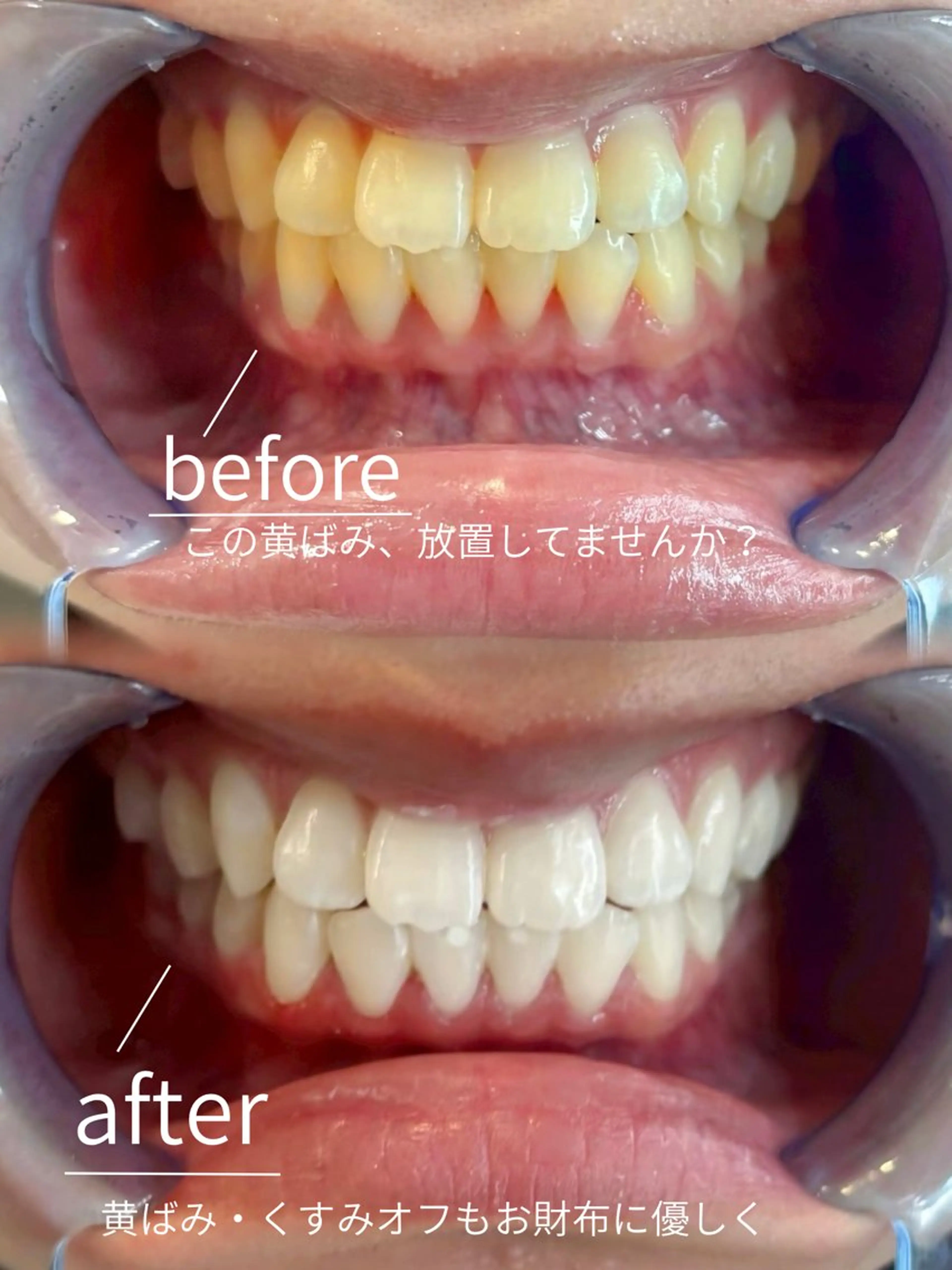 B onitoのエステ・リラクイメージ