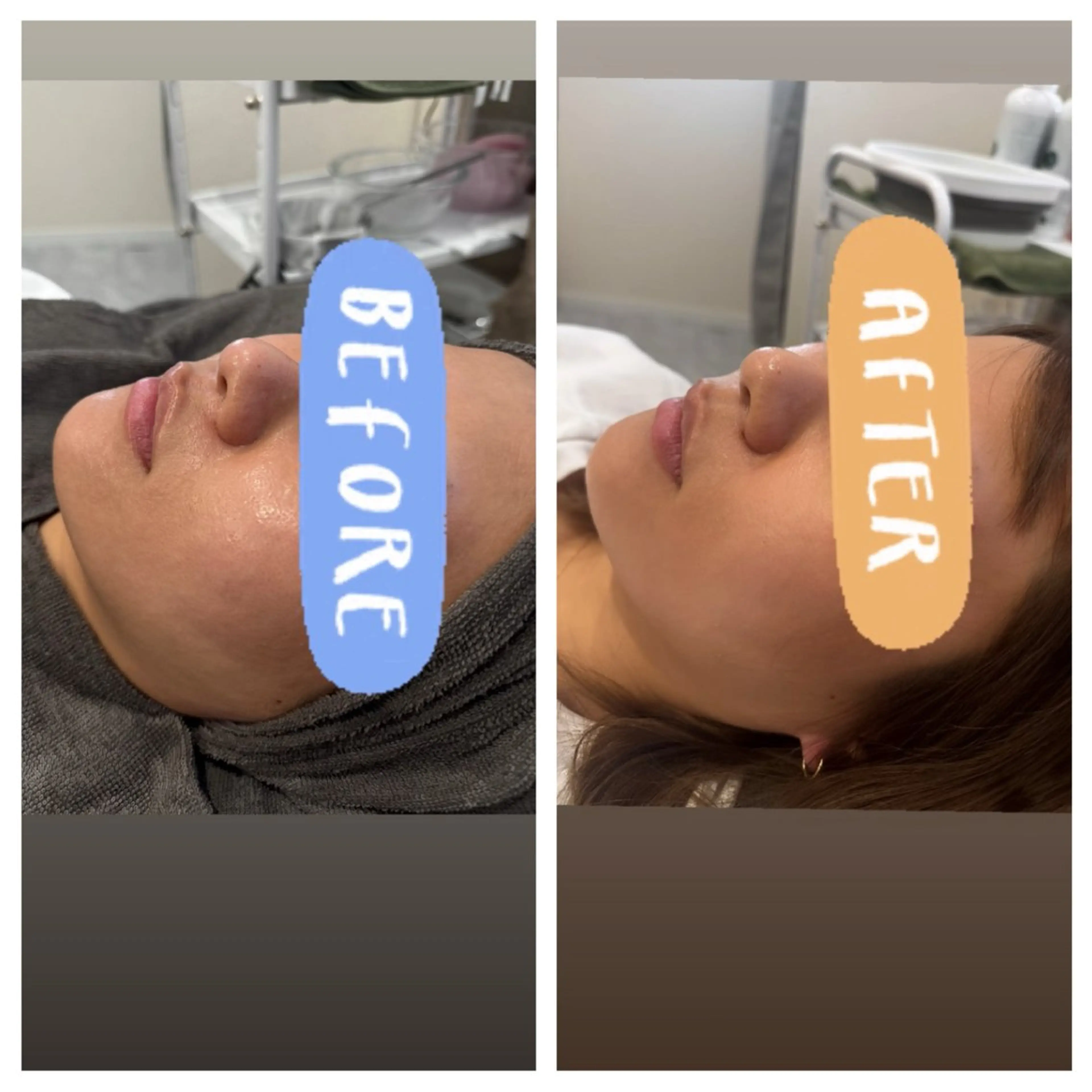 エステ R'beauty所属・R'beauty ・karinのマツエク・マツパデザイン