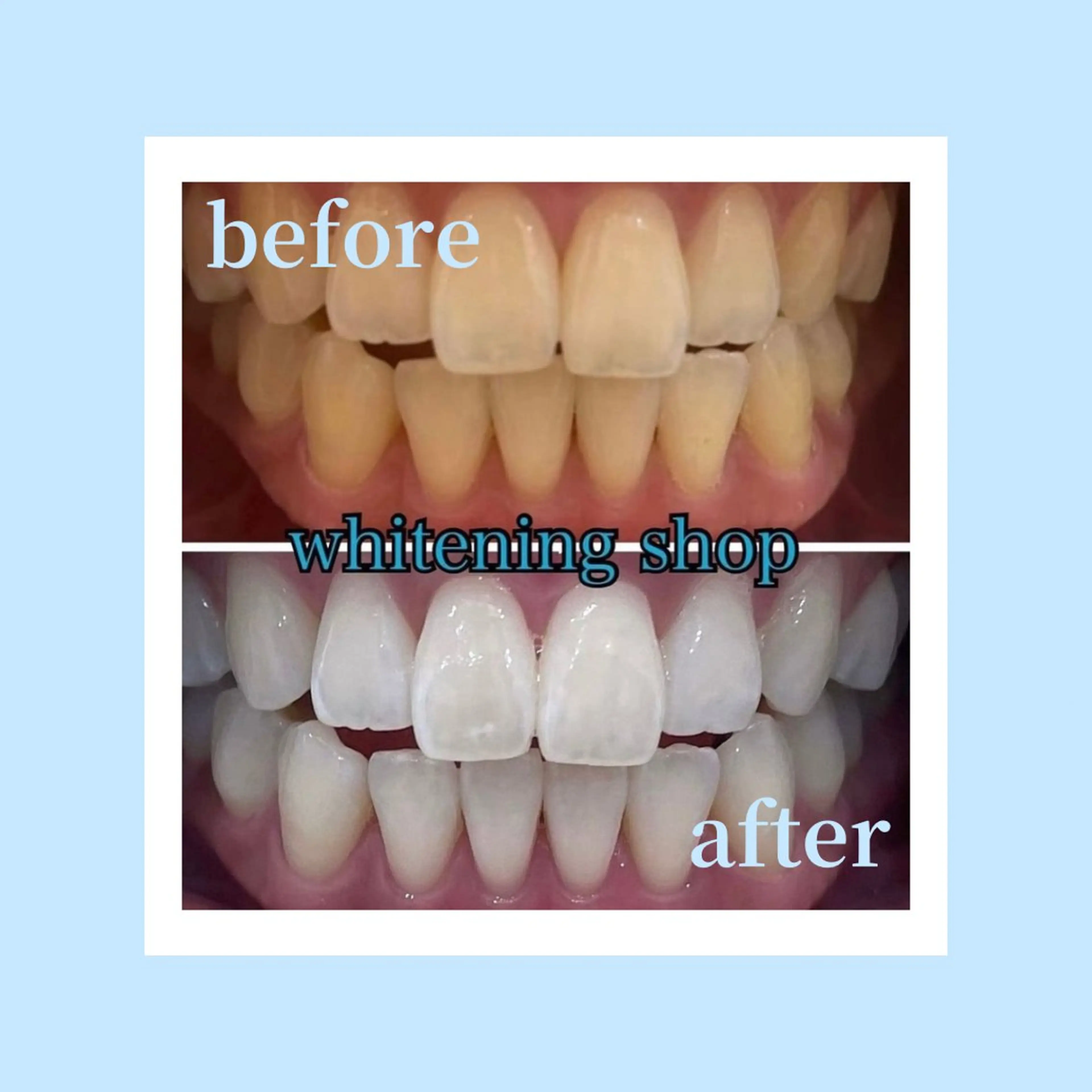 ホワイトニングショップ光明池店所属・ホワイトニング ショップ光明池店のエステ・リラクイメージ