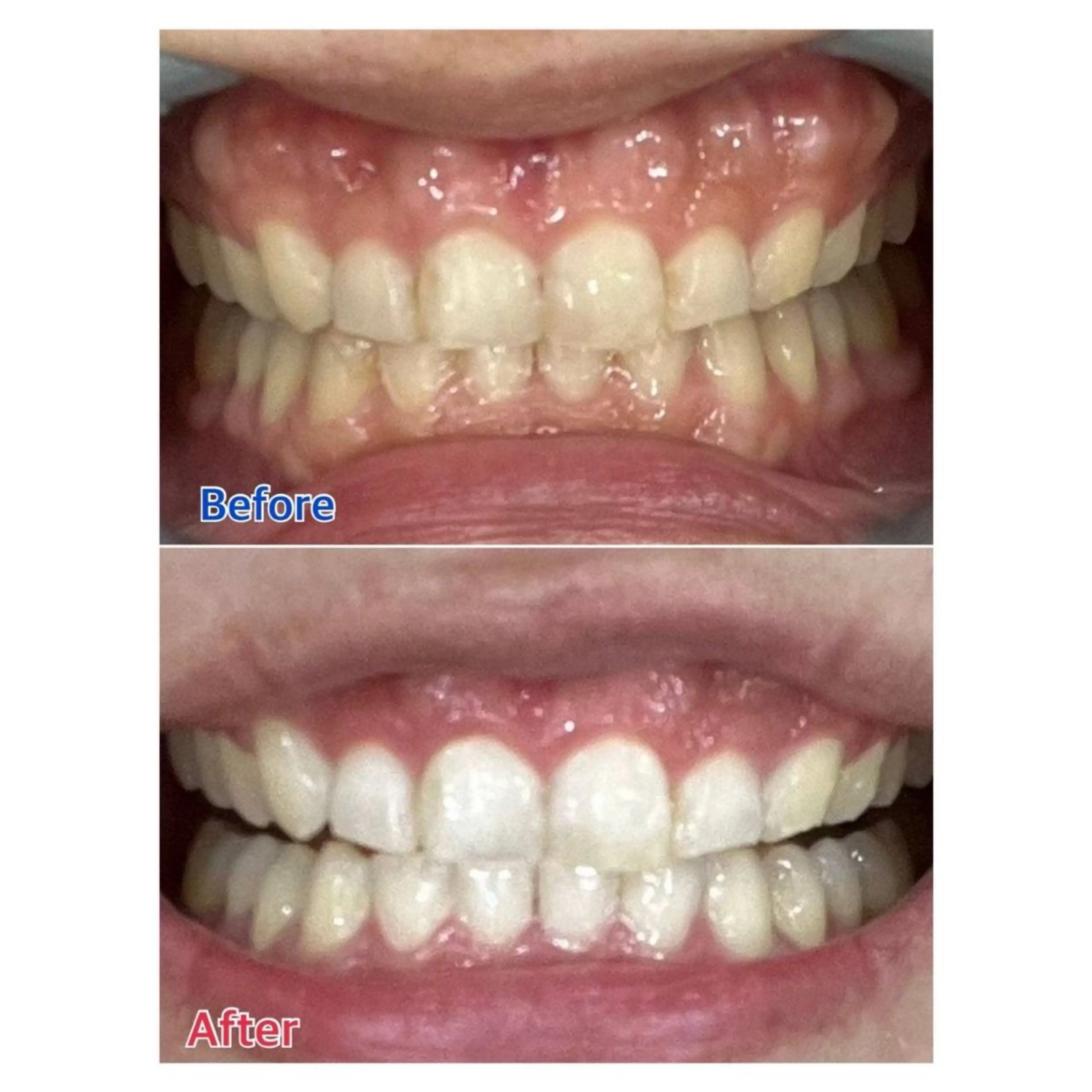 MBEAUTYSALON 千葉店・京成大久保所属・Melty 輝のその他イメージ