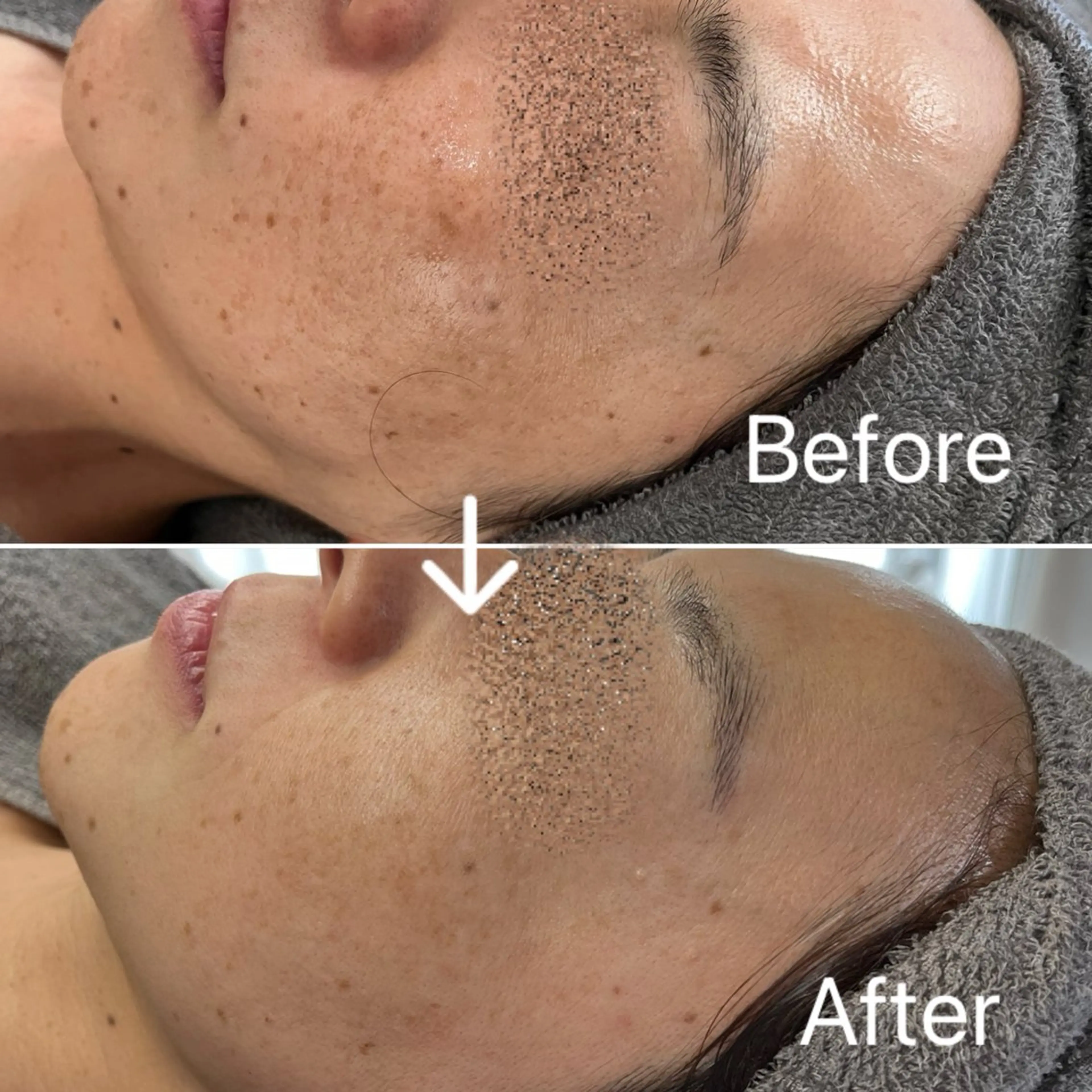 Blue Moon 【ブルームーン】のエステ・リラクイメージ