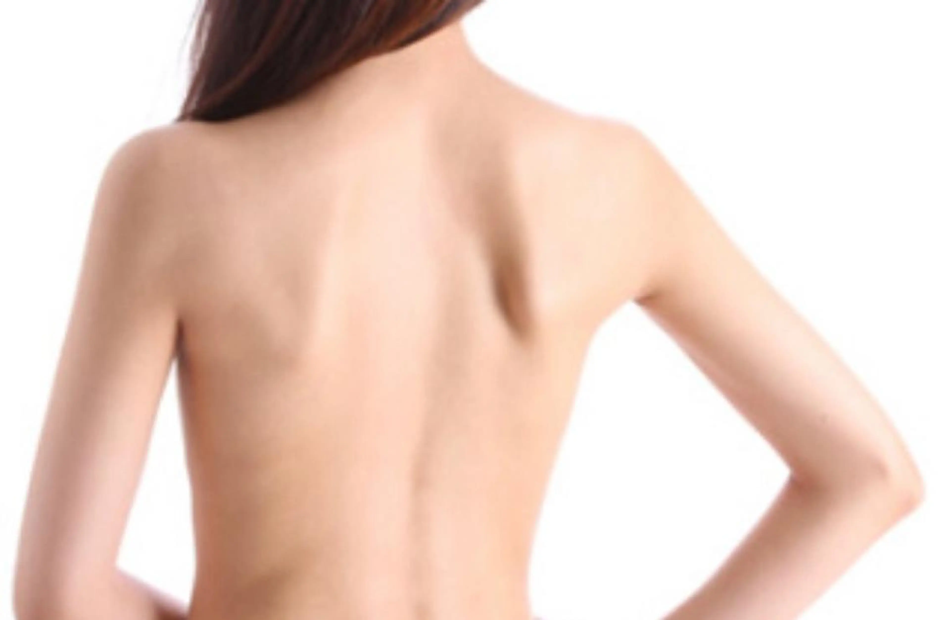 初回全身脱毛(V.I.Oなし)の写真