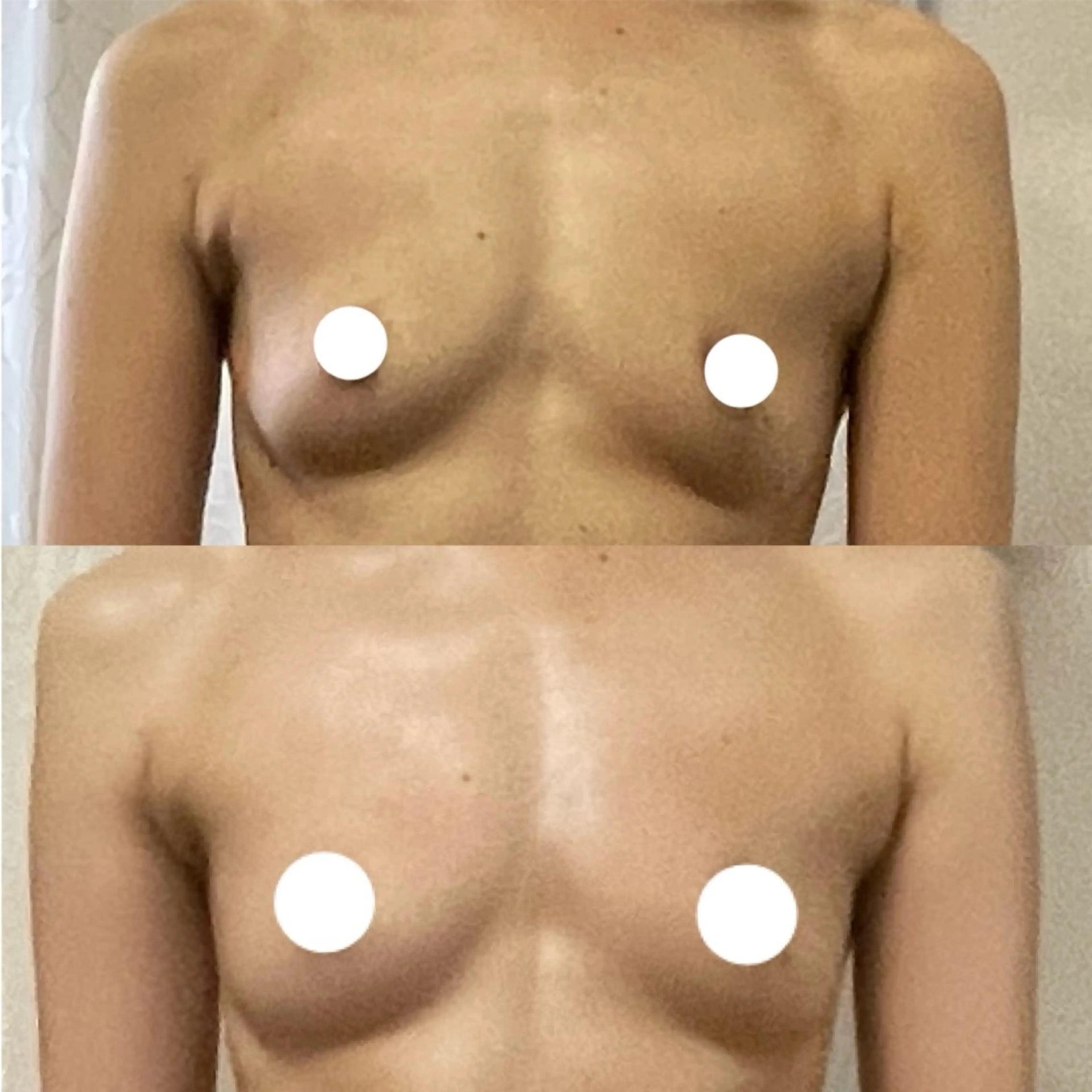 エステ リラク バストアップサロン 💎MARINE💎のエステ・リラクイメージ