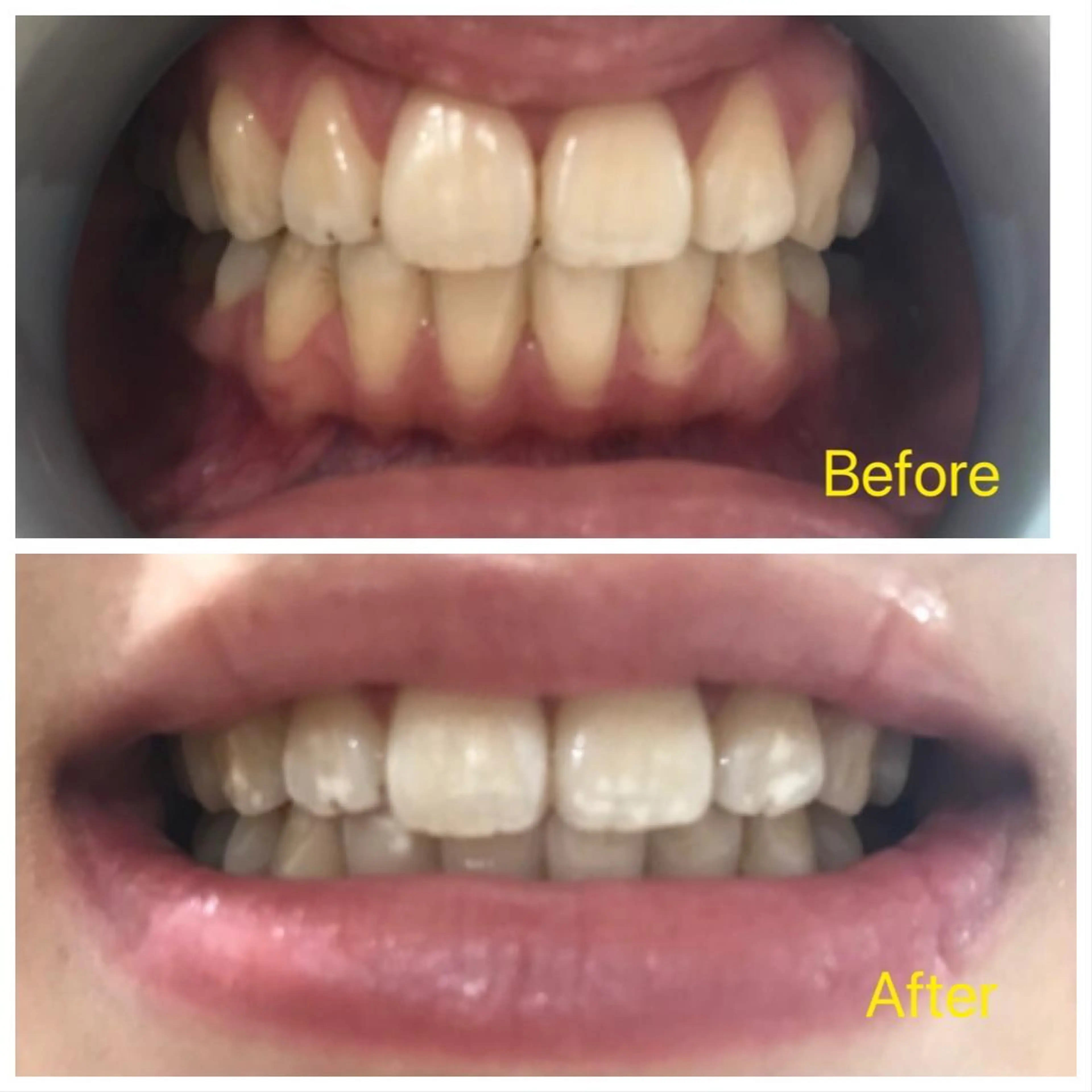 M渋谷店所属・Ｍ渋谷 ホワイトニングのエステ・リラクイメージ