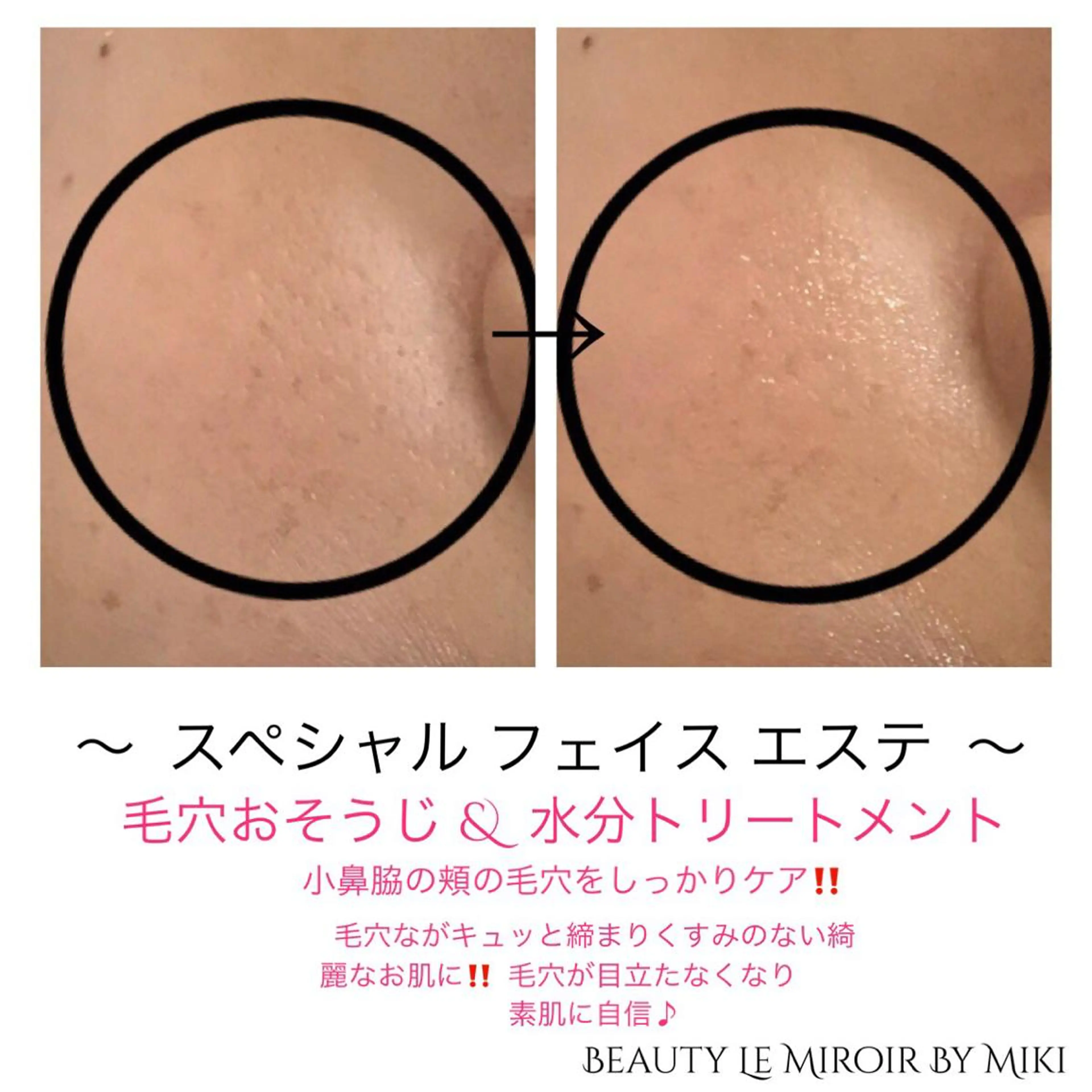 ビューティー ミロワールのエステ・リラクイメージ