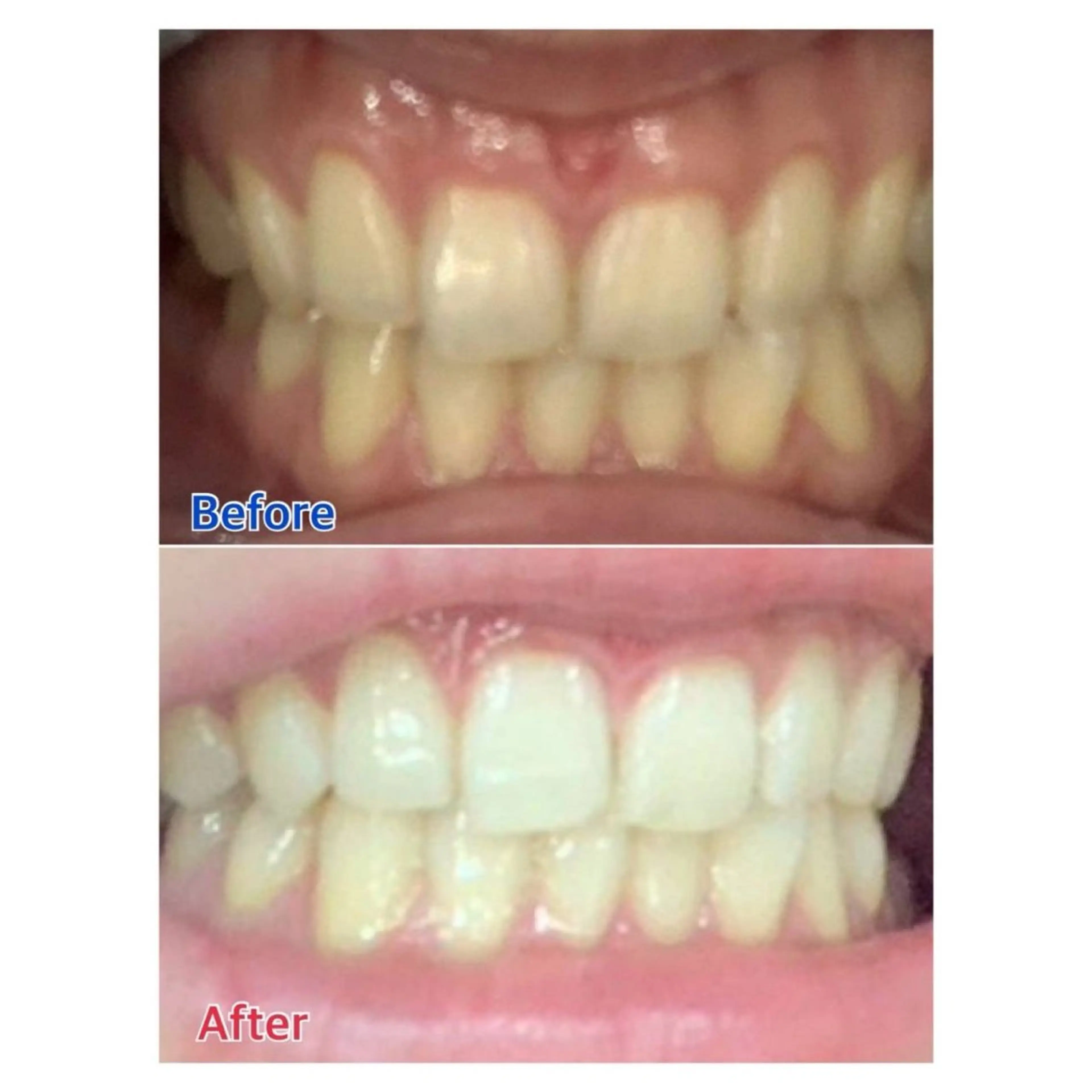 MBEAUTYSALON 千葉店・京成大久保所属・Melty 輝のその他イメージ