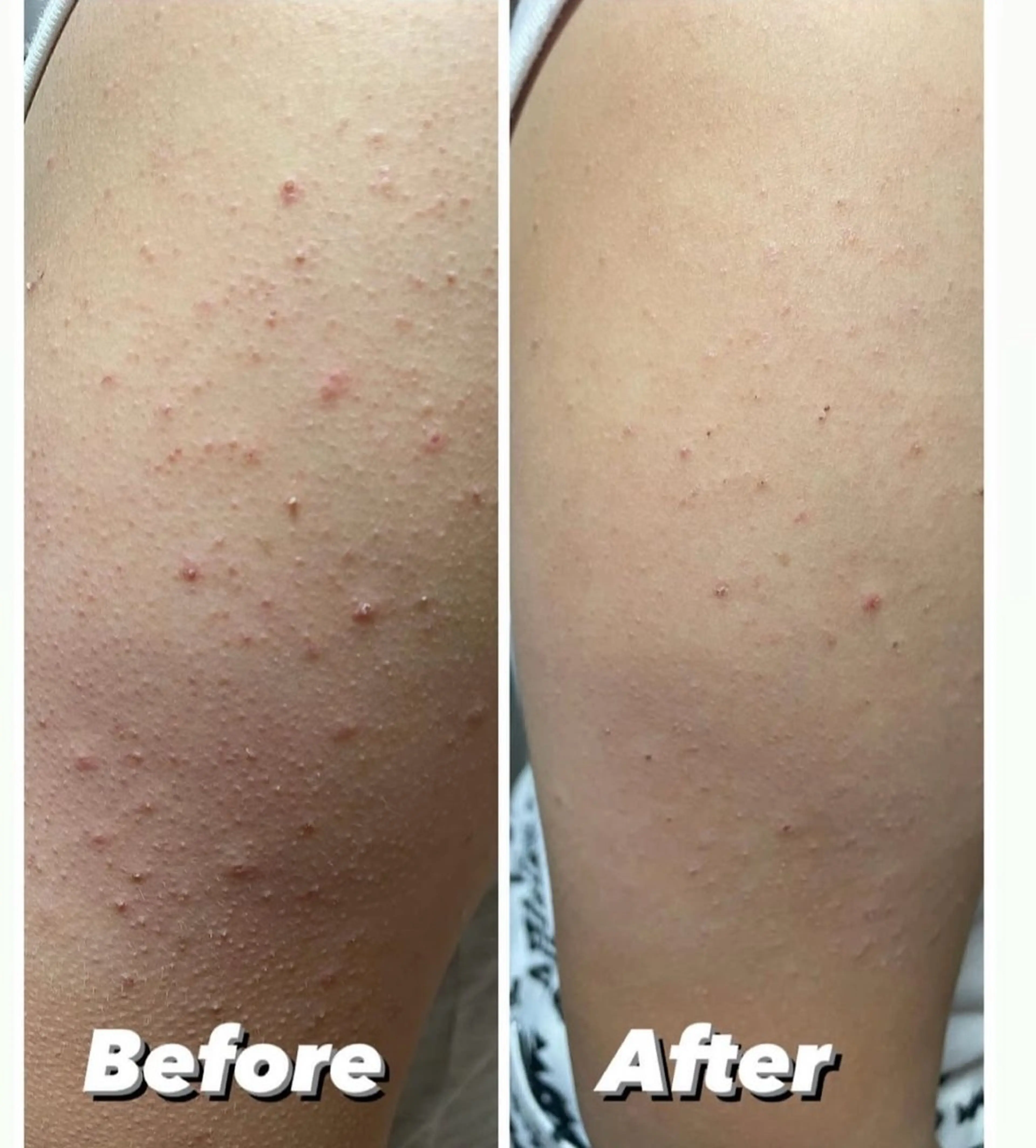 メンズ キッズ 学生（メンズ向け） 韓国最先端技術サロン Luangeのエステ・リラクイメージ