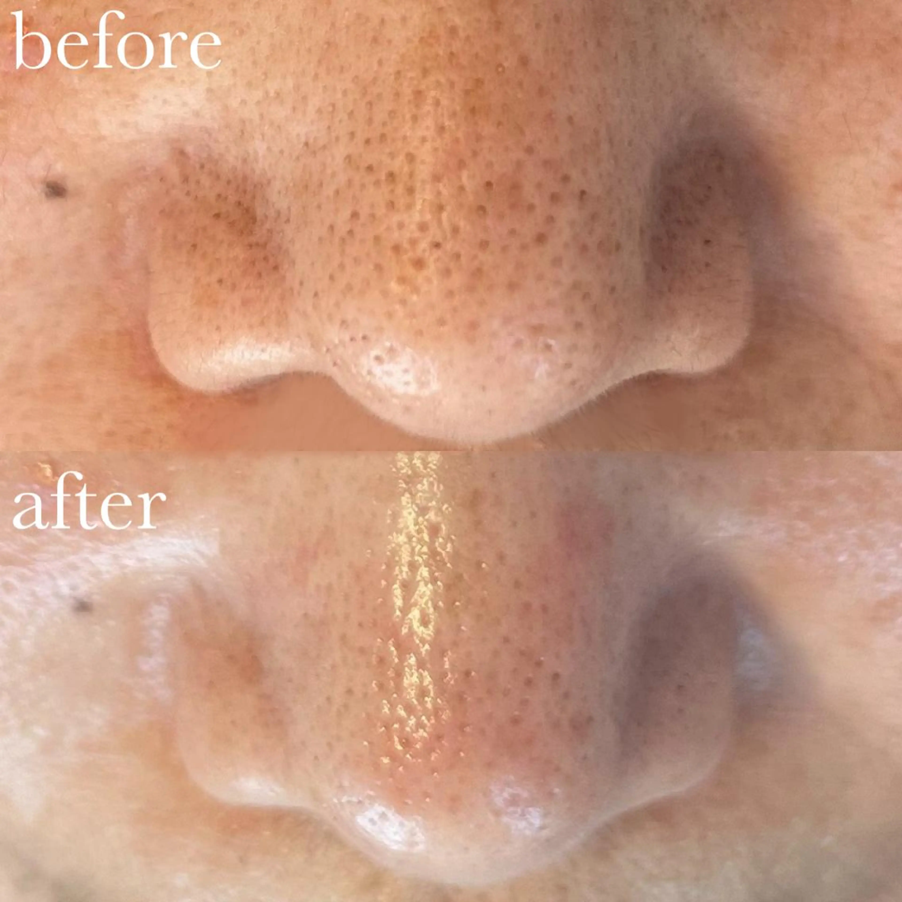 Luana  アイラッシュ& フェイシャル所属・Luana eyelashのマツエク・マツパデザイン