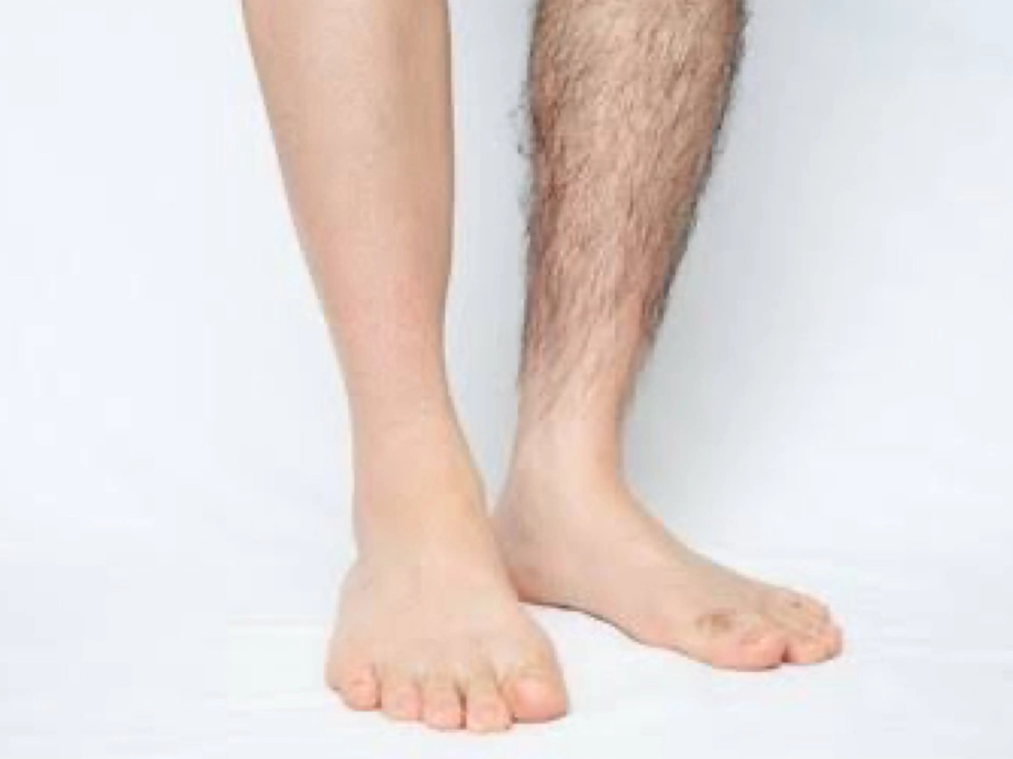 【メンズ】脇＋腕＋足 3カ所セットの写真