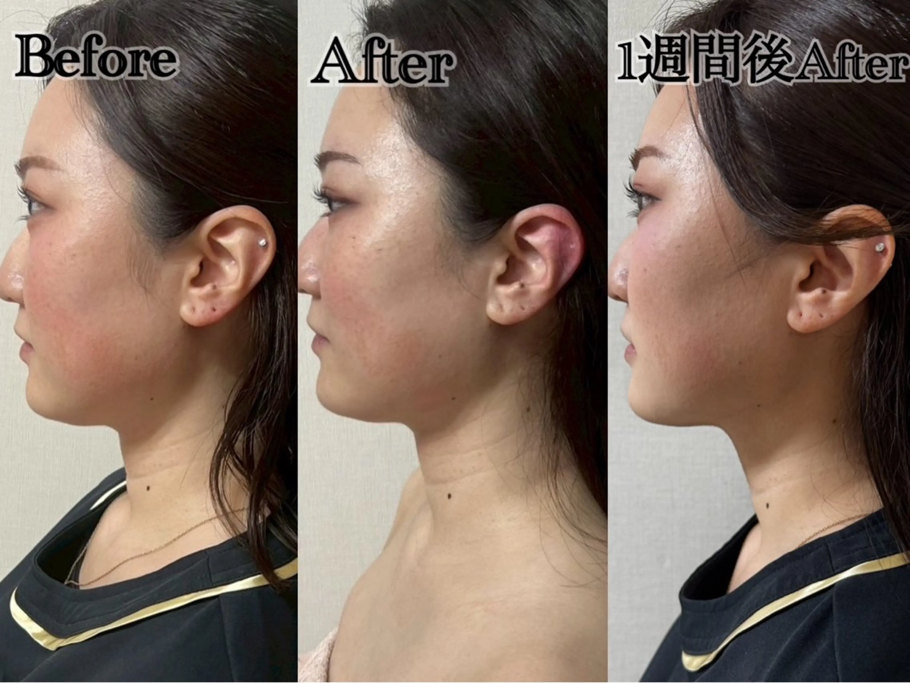 エステ 六本木/似合わせ眉毛 andＳ🍀Yuriのエステ・リラクイメージ