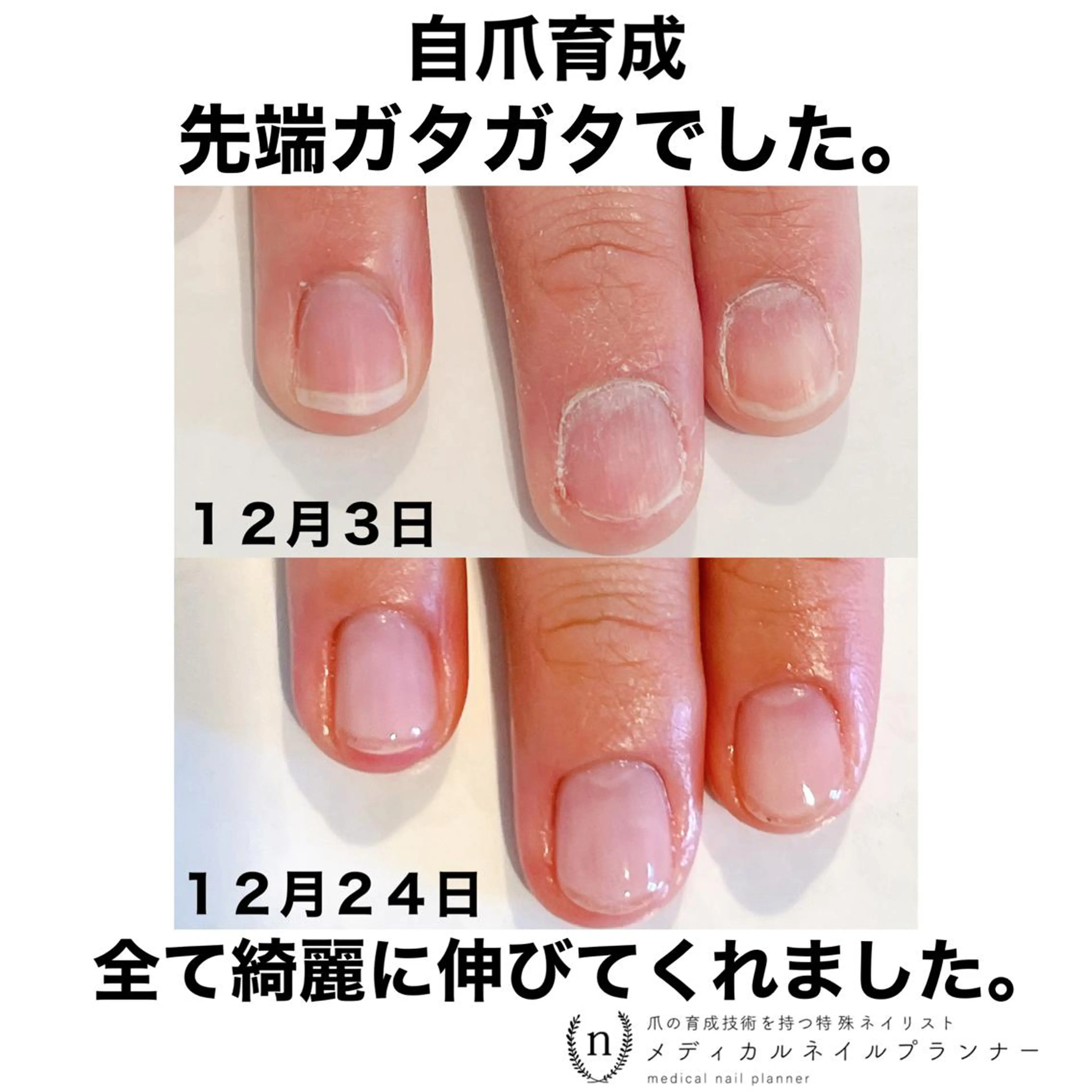 ネイル NAIL SALON ｔｏｇｇｙのネイルデザイン