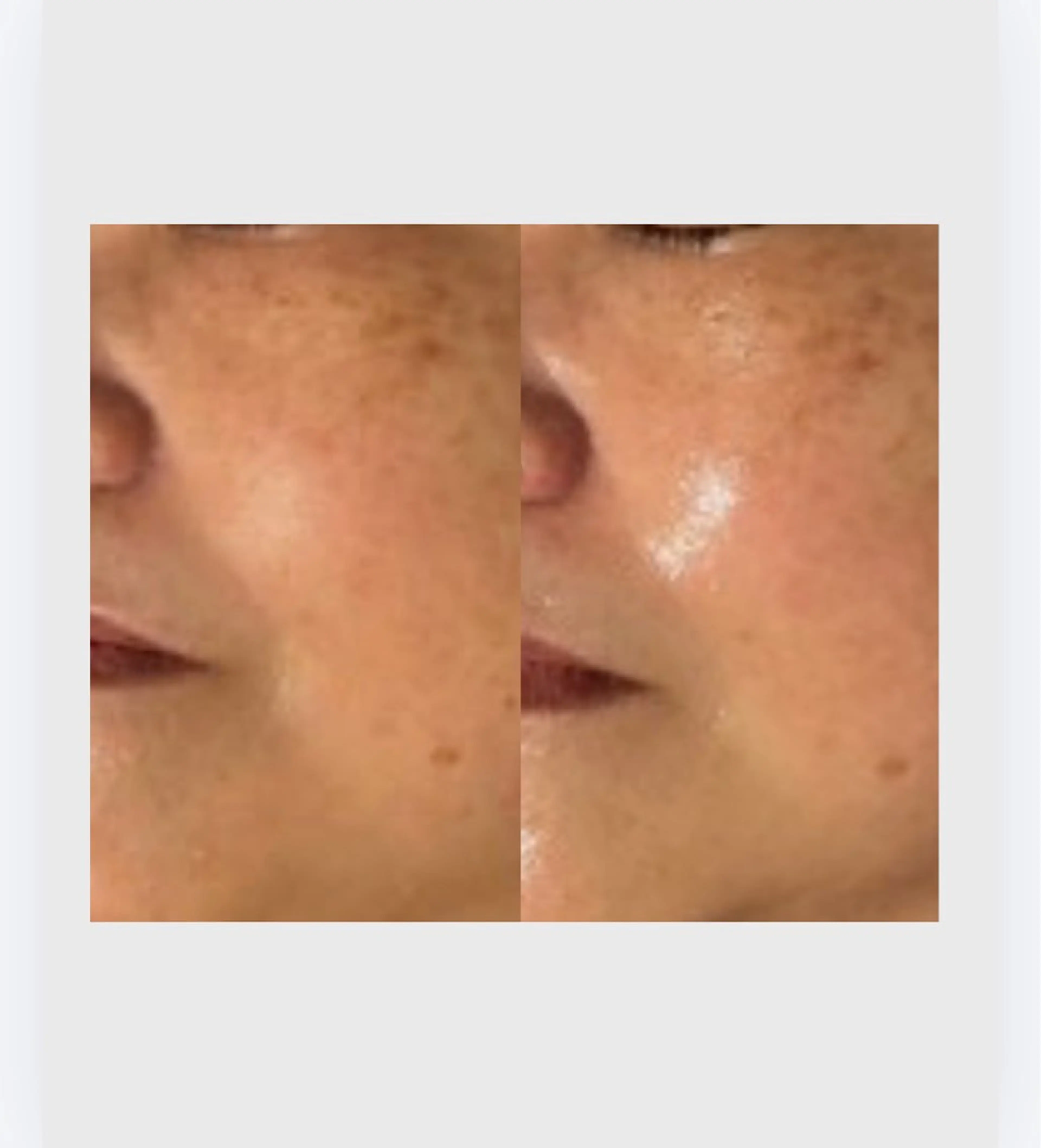 肌管理フェイシャル|Utouto所属・肌管理フェイシャル Utoutoのエステ・リラクイメージ