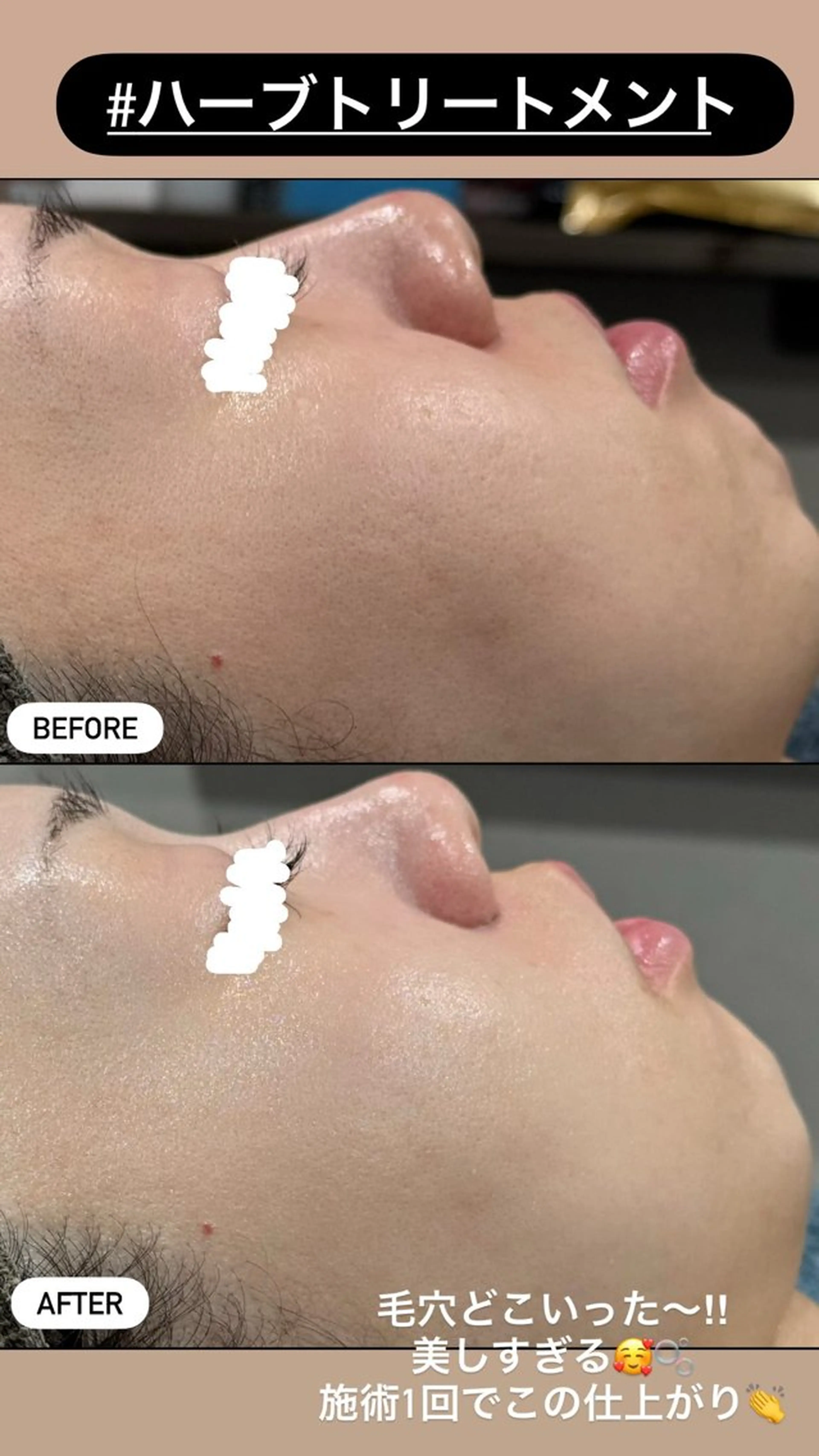 エステ LiZA エステティックサロンのエステ・リラクイメージ