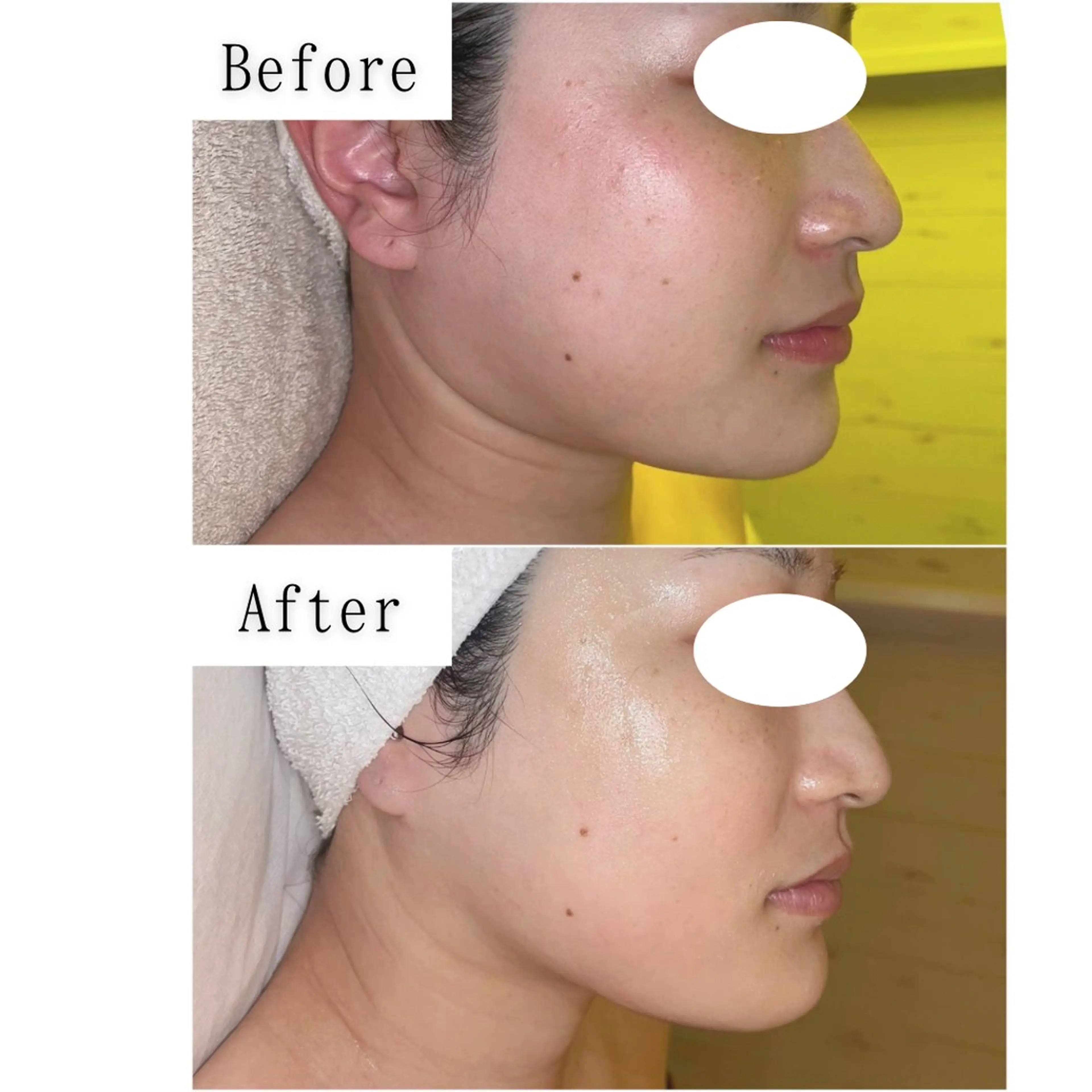 エステ SELF  BEAUTY gracia浦添店所属・gracia 浦添店のその他イメージ