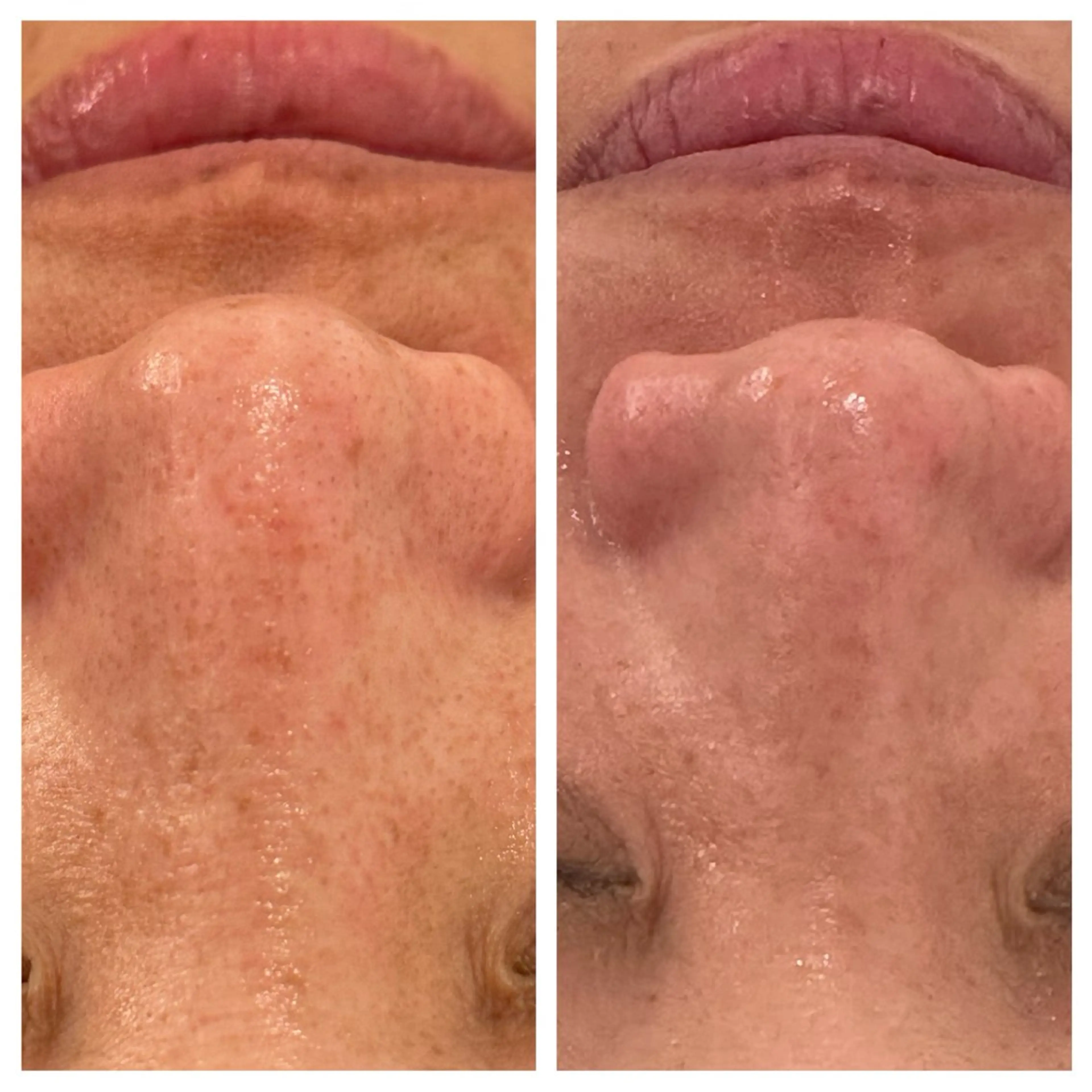 エステ リラク ANERA Second所属・尾上 沙織のエステ・リラクイメージ