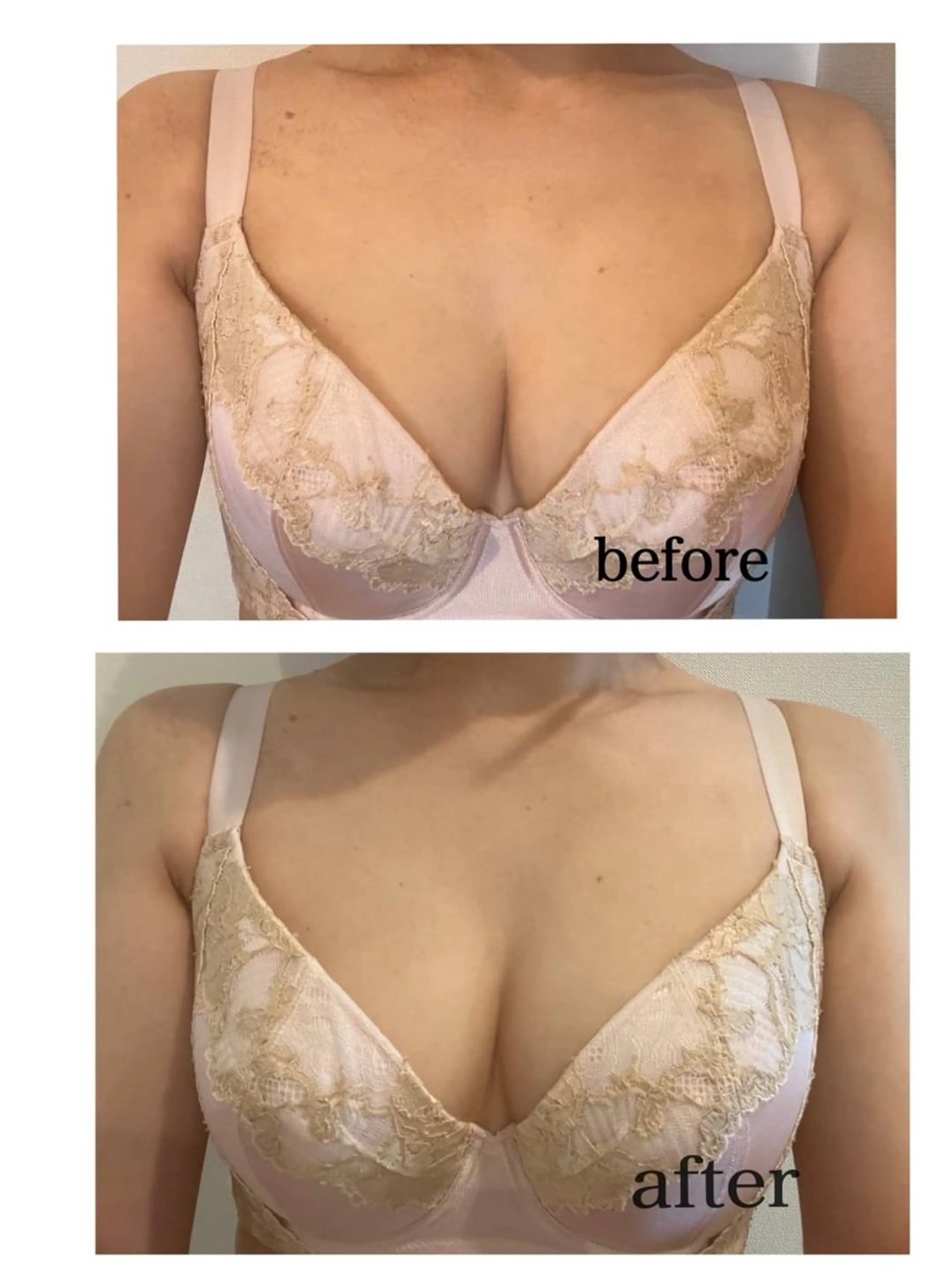 トータルビューティー kinoseのエステ・リラクイメージ