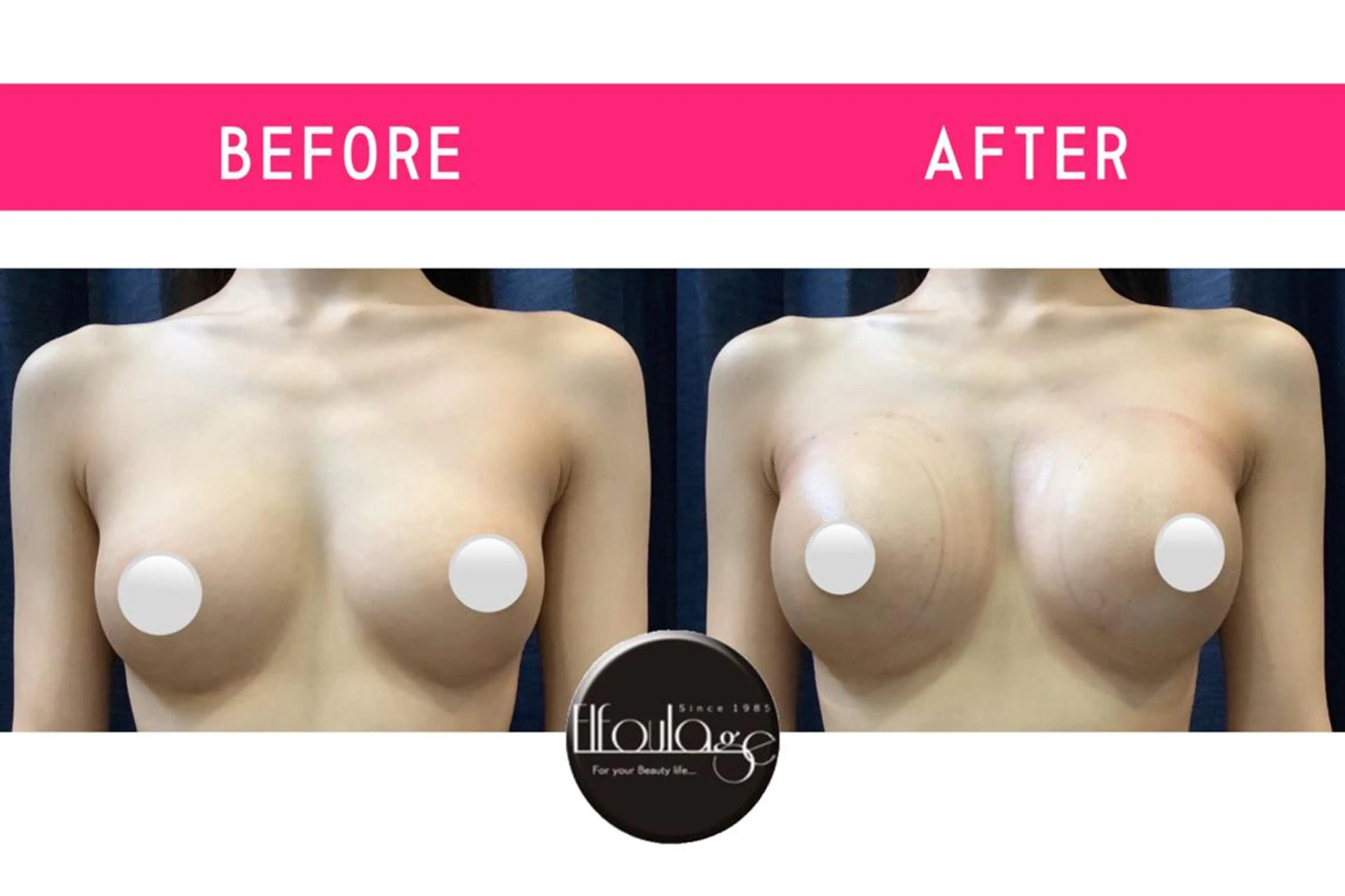 エルフラージュ 銀座店のエステ・リラクイメージ