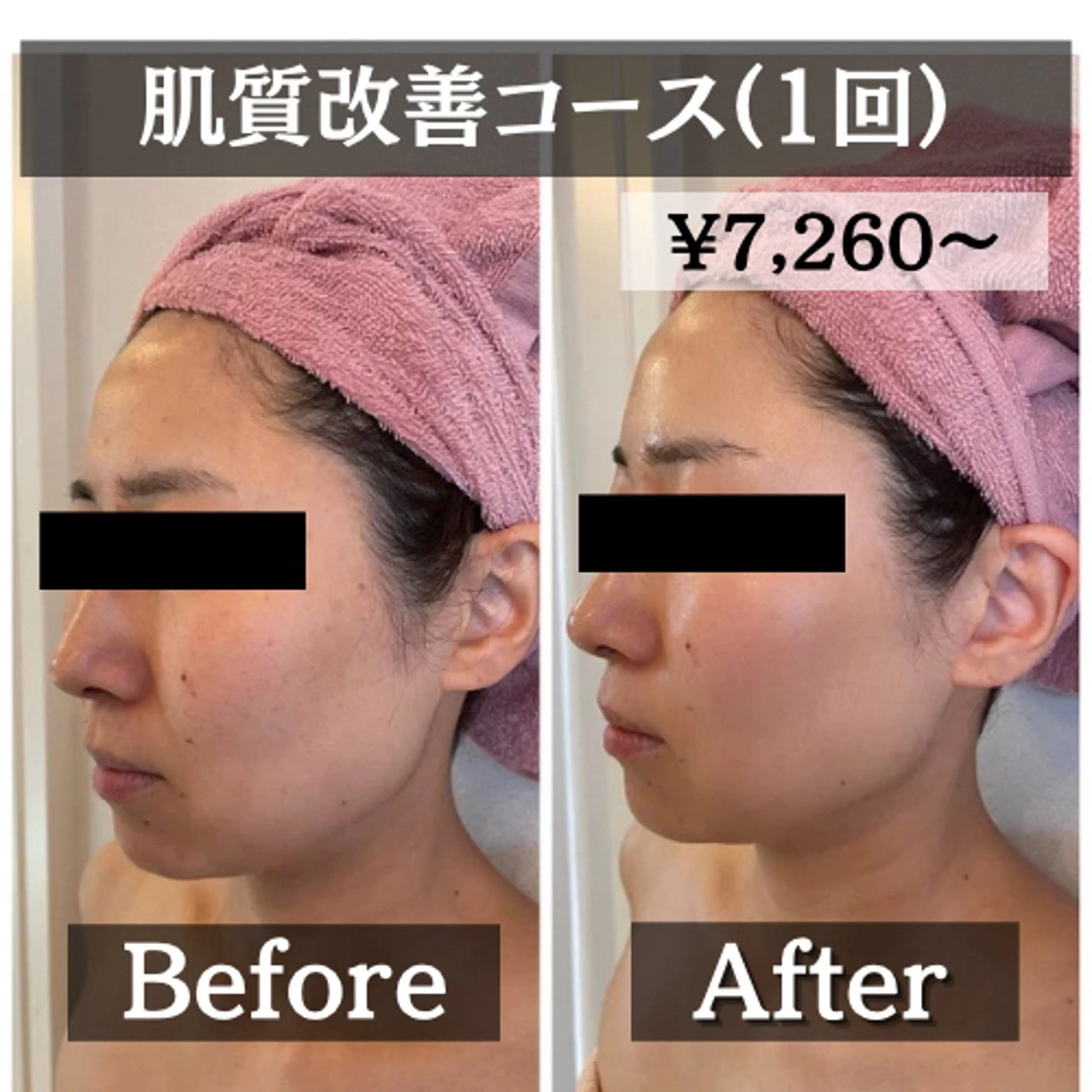 エステ リラク 【肌質改善・リフトアップ専門店】セラピックエステ美極所属・羽賀 茉衣子のエステ・リラクイメージ